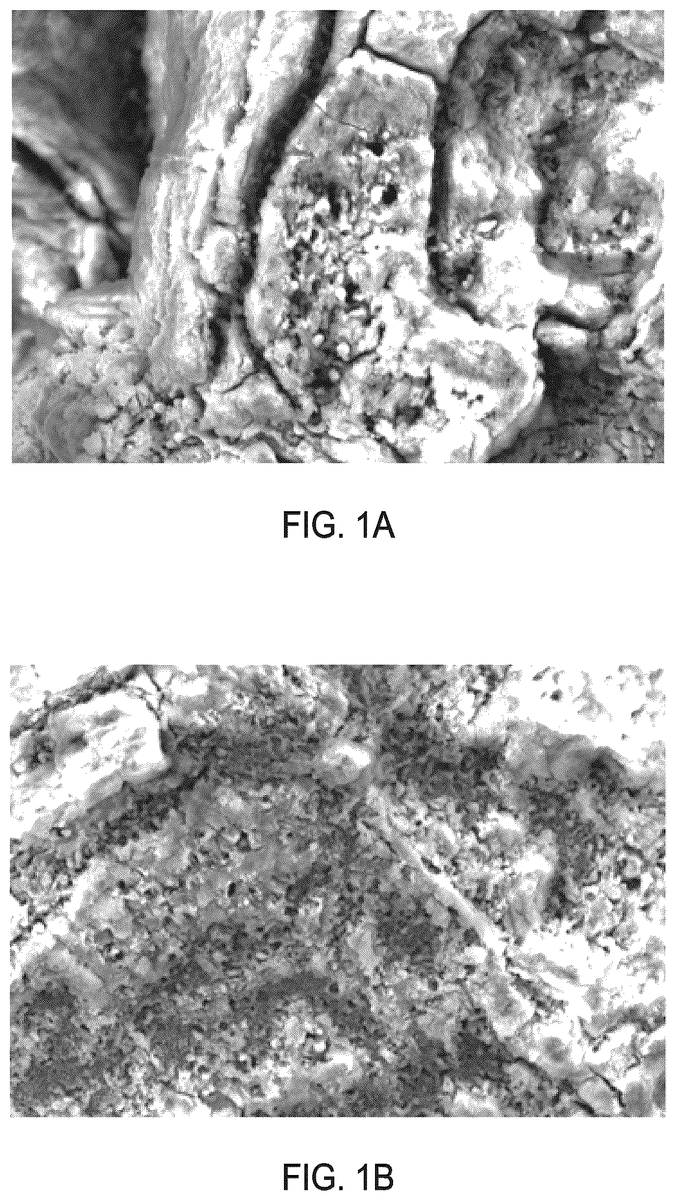 Patent US12616576 Figure 1 – Methods of modifying the porous surface of implants