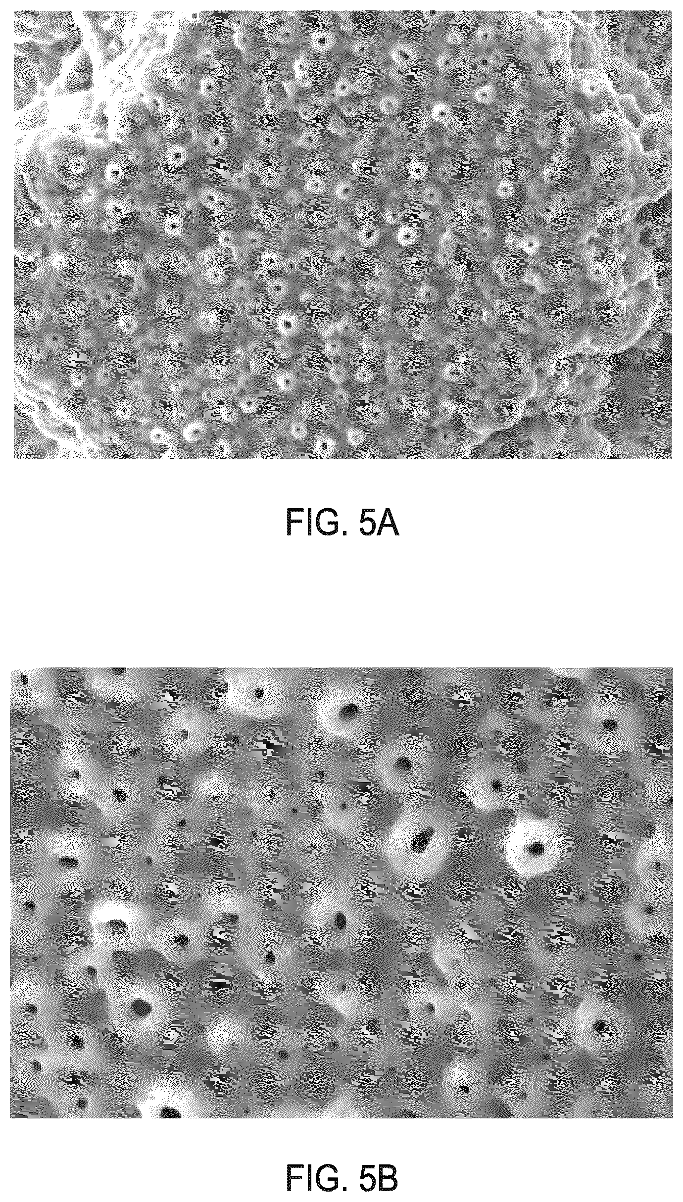 Patent US12616576 Figure 5 – Methods of modifying the porous surface of implants