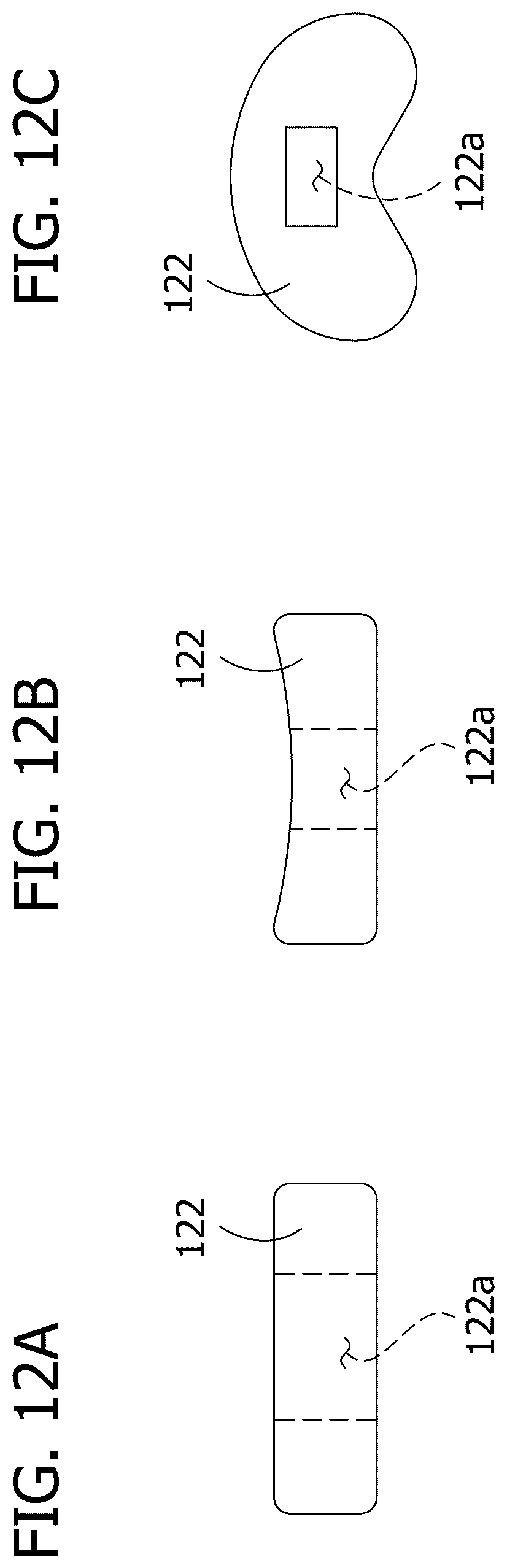 Patent US12616577 Figure 9 – Hinged articulating spacer system for revision knee arthroplasty