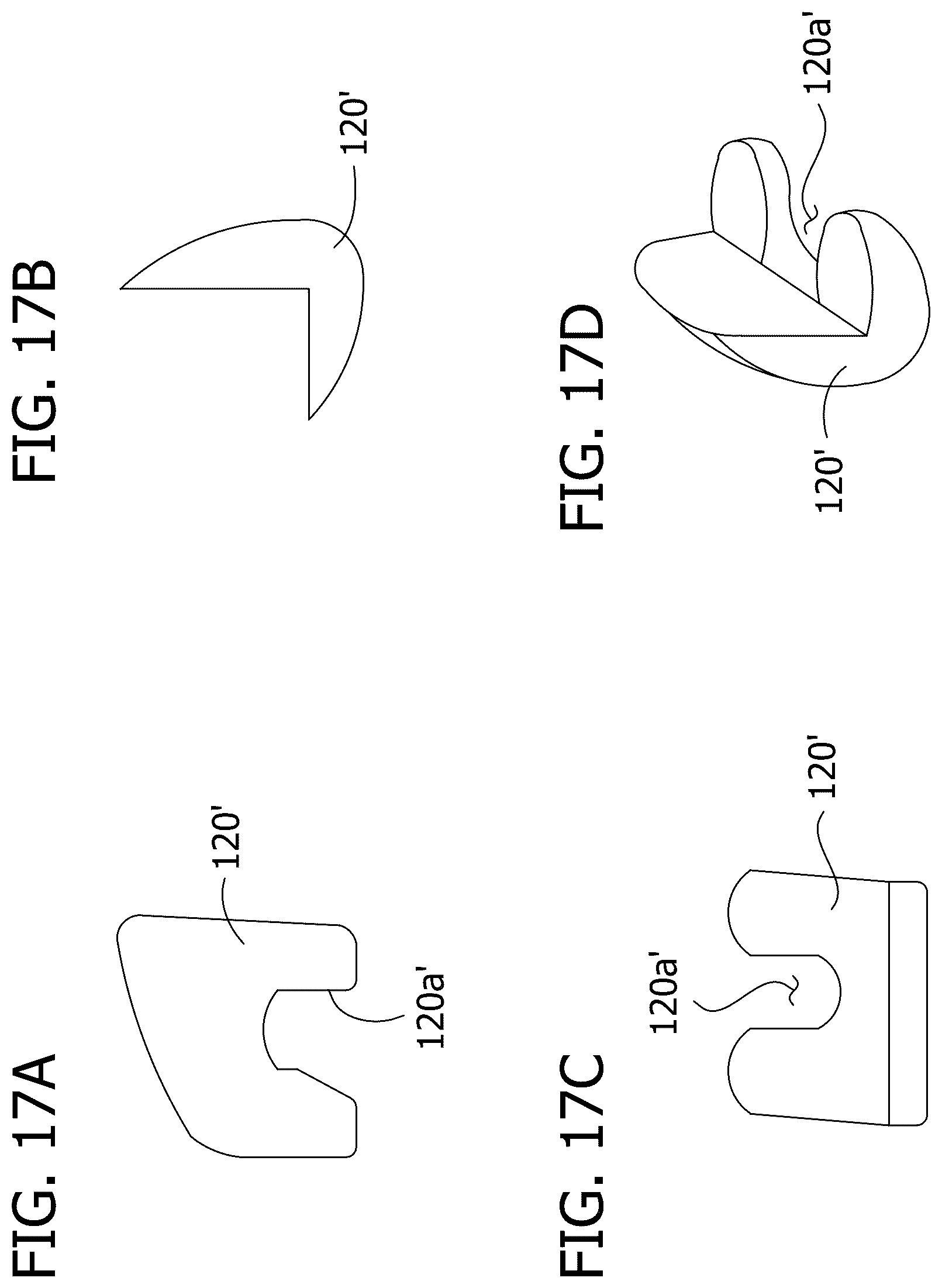 Patent US12616577 Figure 13 – Hinged articulating spacer system for revision knee arthroplasty