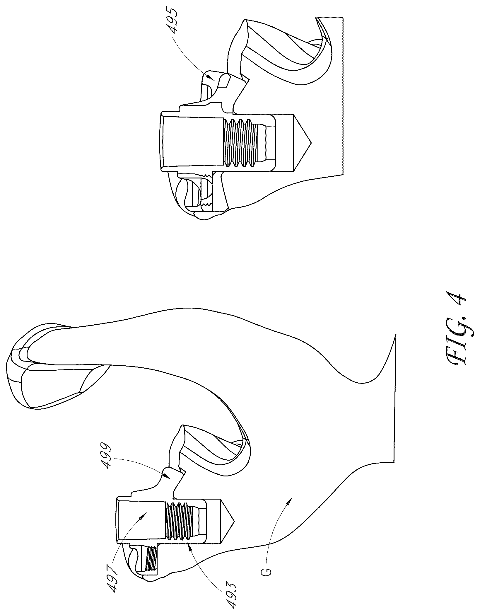 Patent US12616578 Figure 4 – Total reverse shoulder systems and methods