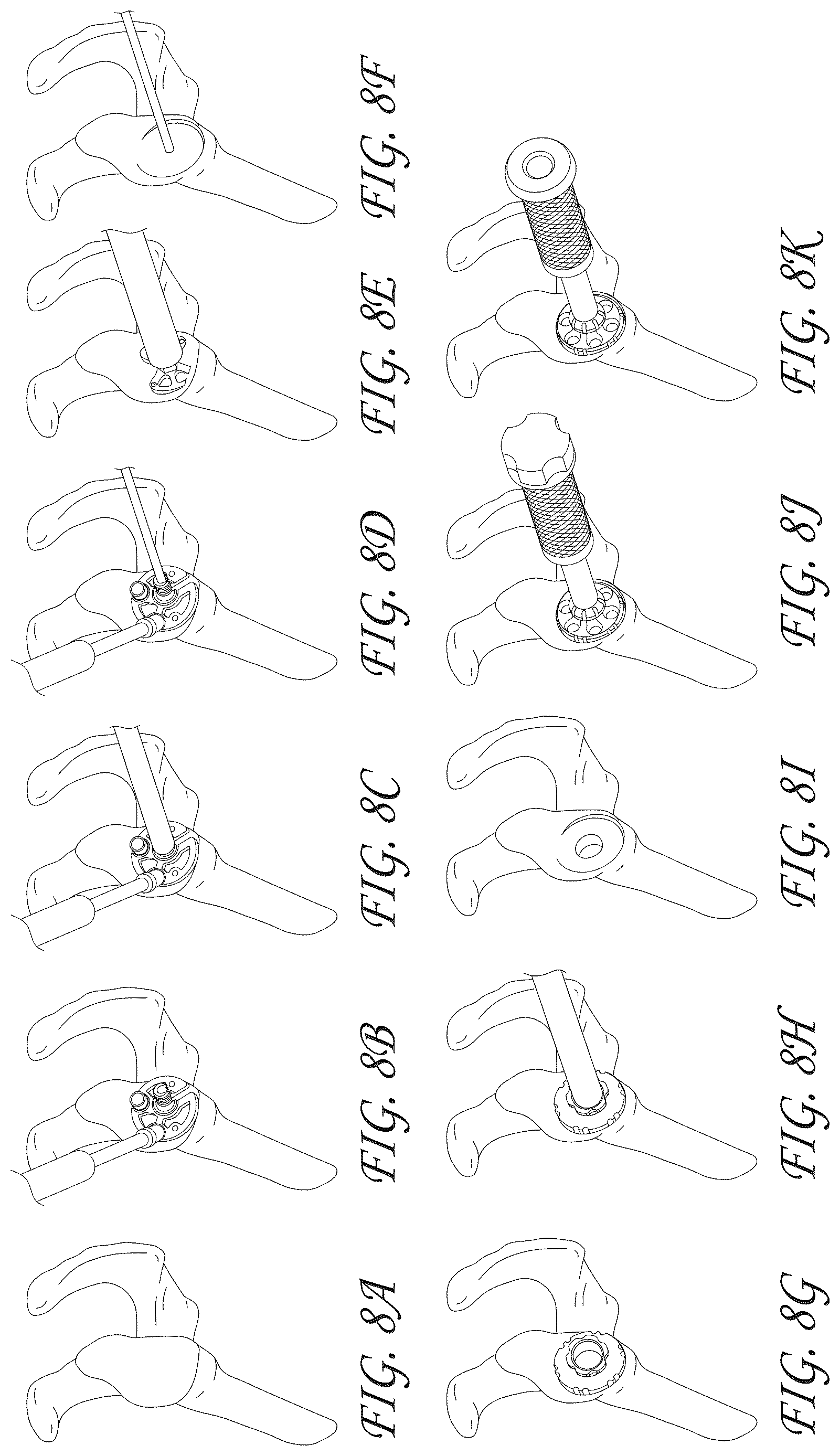 Patent US12616578 Figure 9 – Total reverse shoulder systems and methods