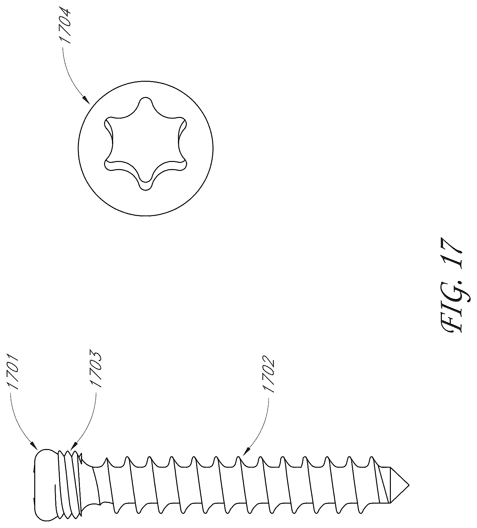 Patent US12616578 Figure 19 – Total reverse shoulder systems and methods