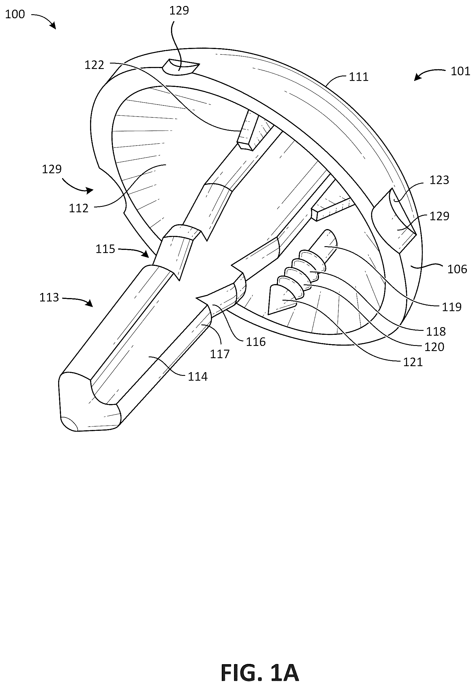 Patent US12616579 Figure 1 – Metatarsal arthroplasty devices, systems, and methods
