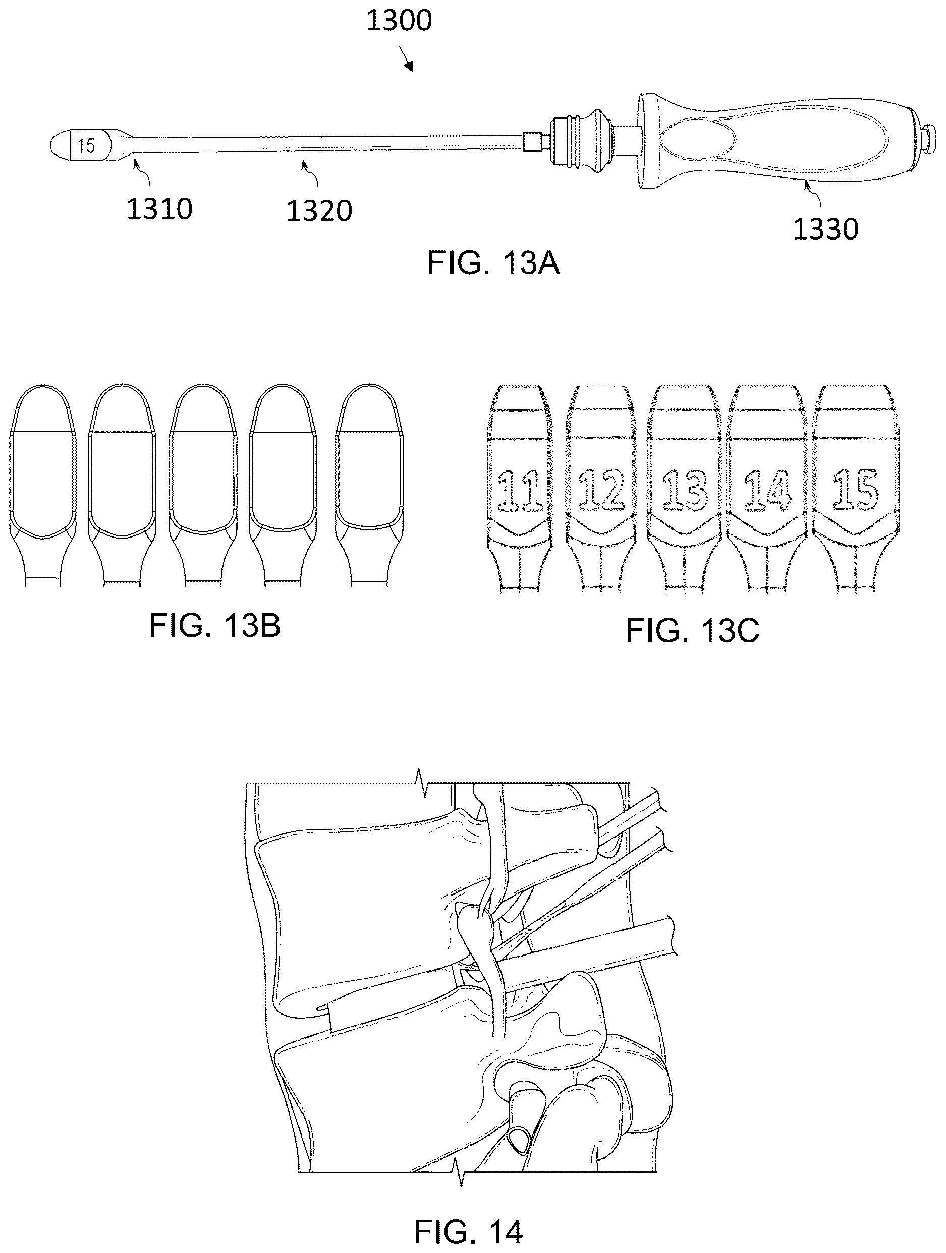 Patent US12616581 Figure 16 – Methods for restoring bilateral spinal alignment and/or range of motion