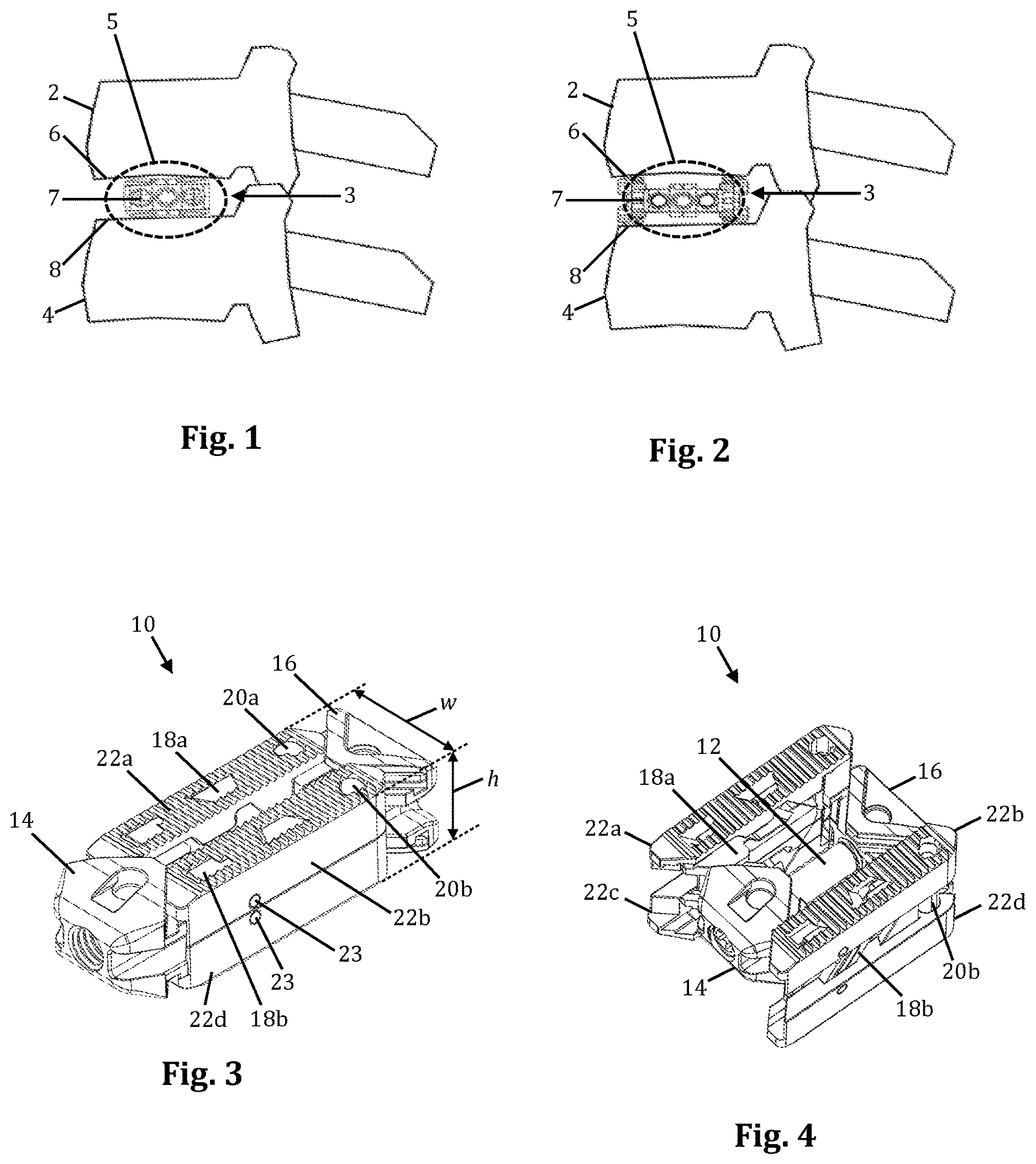 Patent US12616583 Figure 1 – Expandable fusion device with independent expansion systems