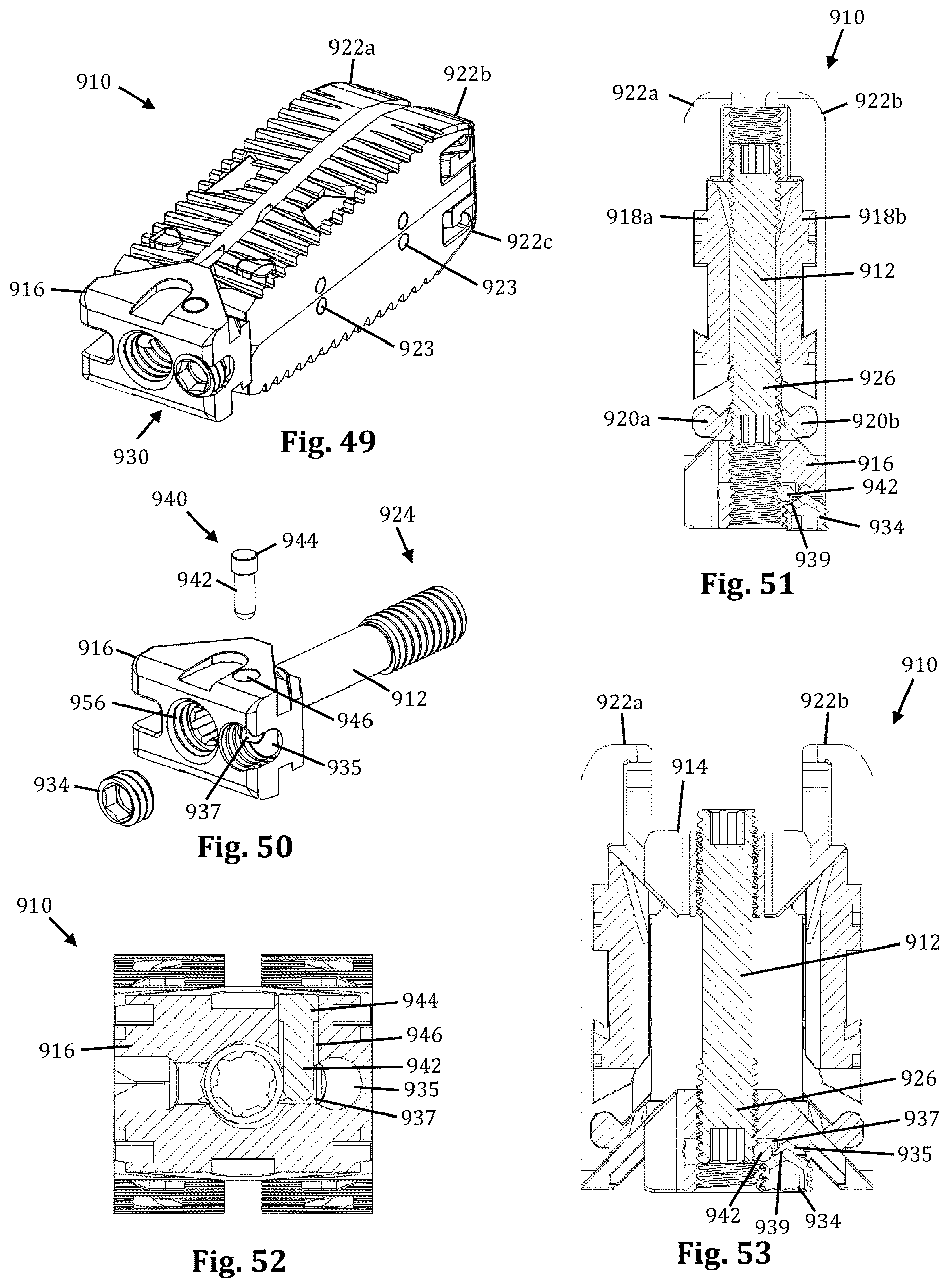 Patent US12616583 Figure 16 – Expandable fusion device with independent expansion systems