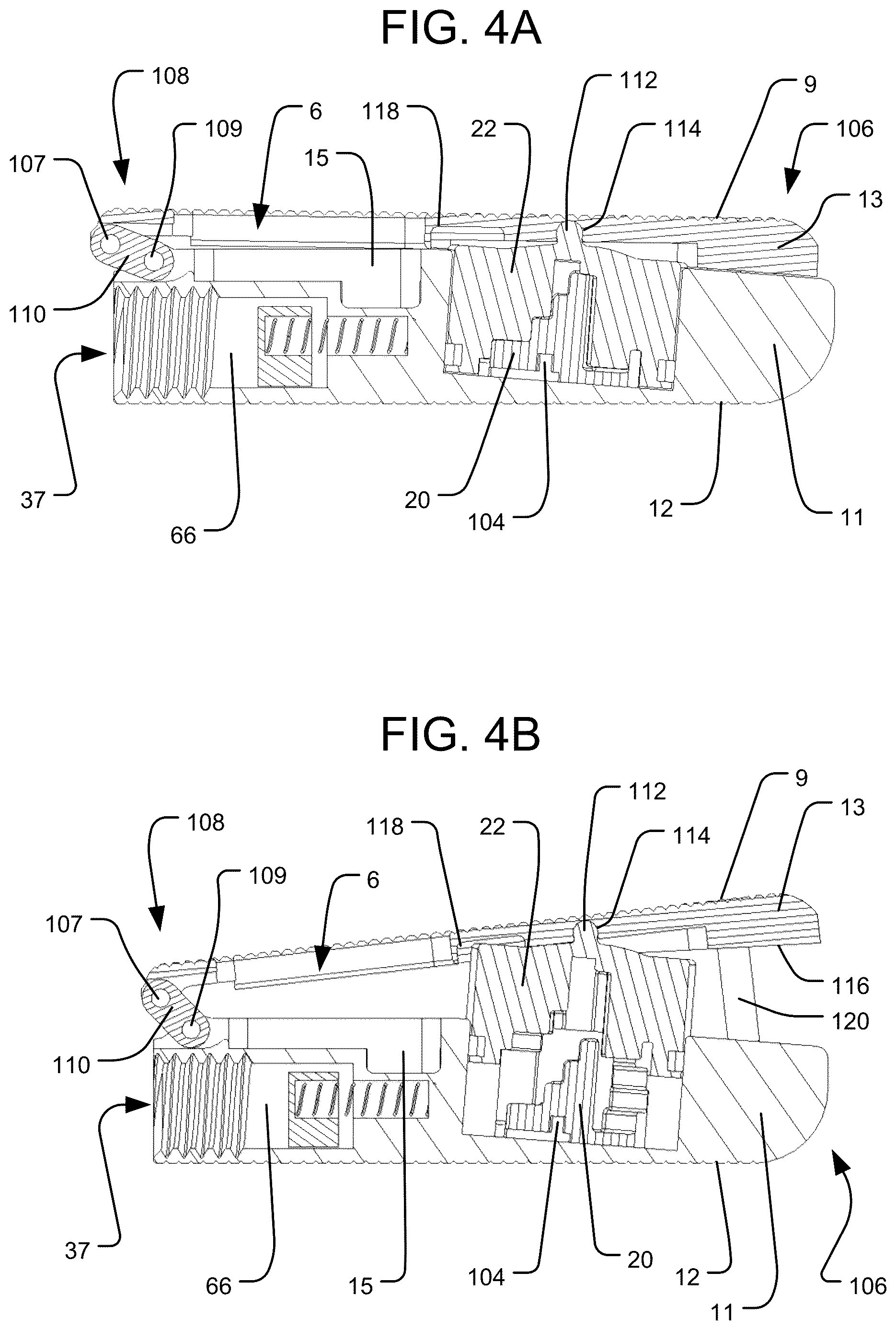 Patent US12616584 Figure 4 – Expandable interbody implant with lordosis correction