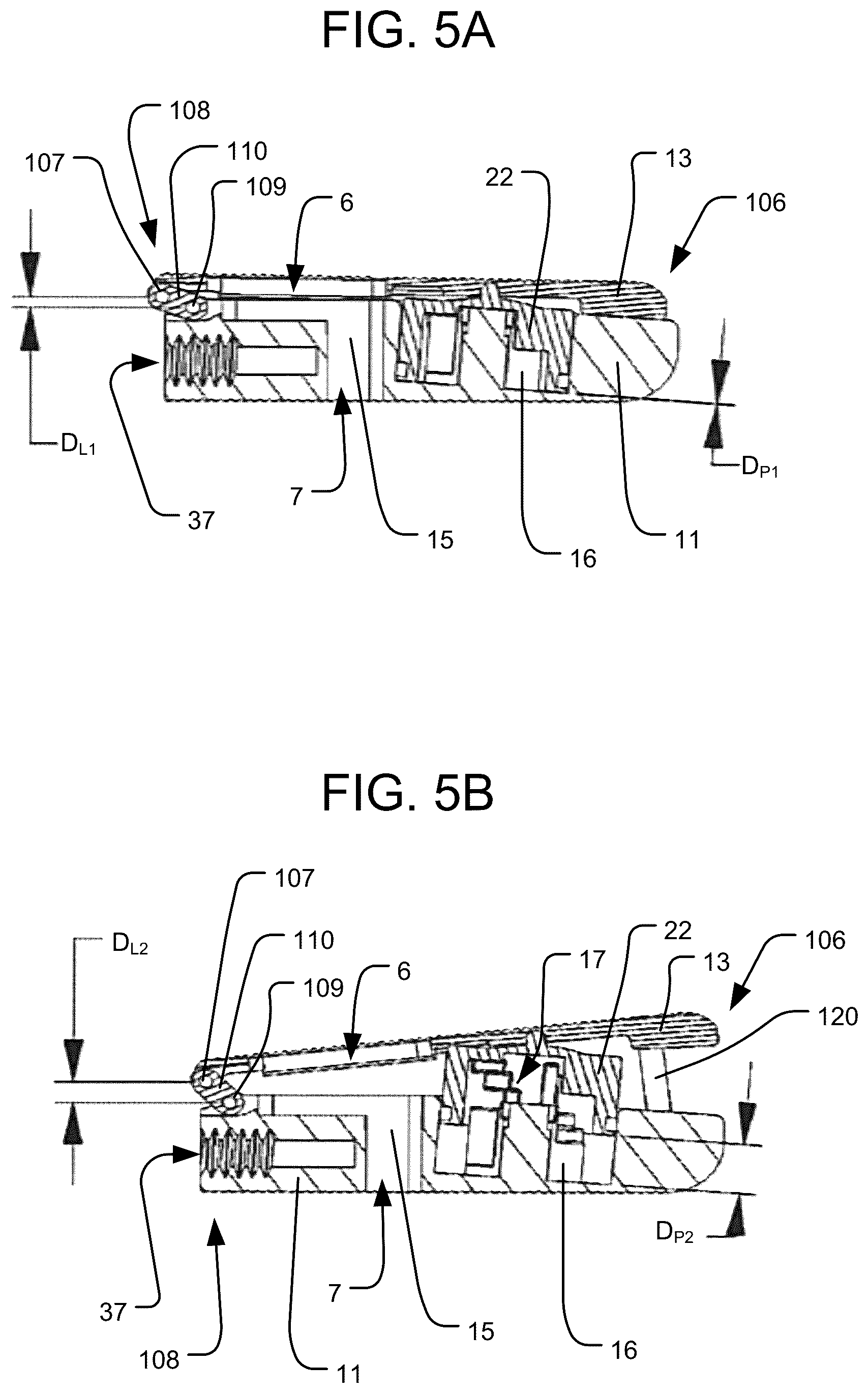 Patent US12616584 Figure 5 – Expandable interbody implant with lordosis correction