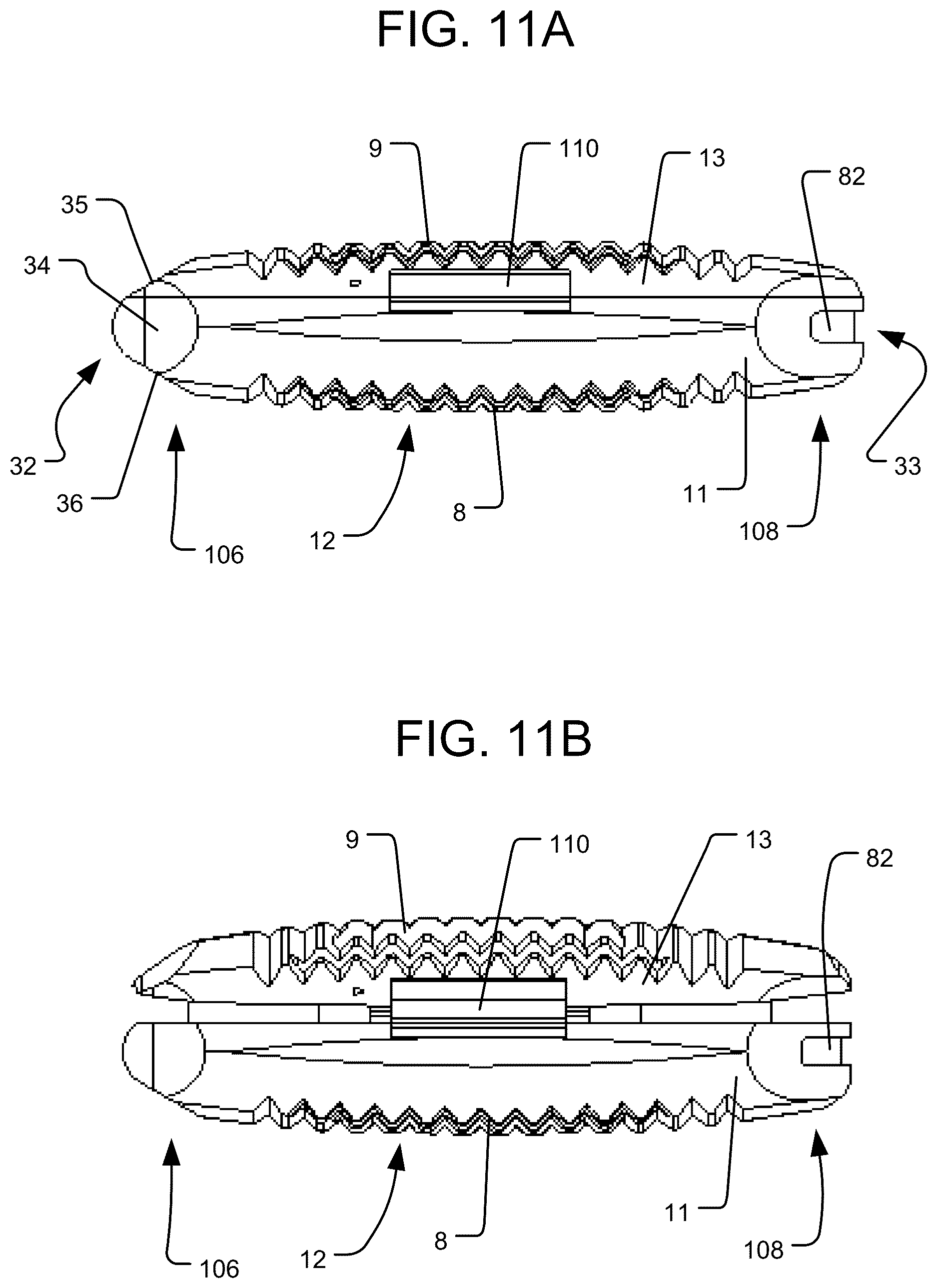Patent US12616584 Figure 11 – Expandable interbody implant with lordosis correction