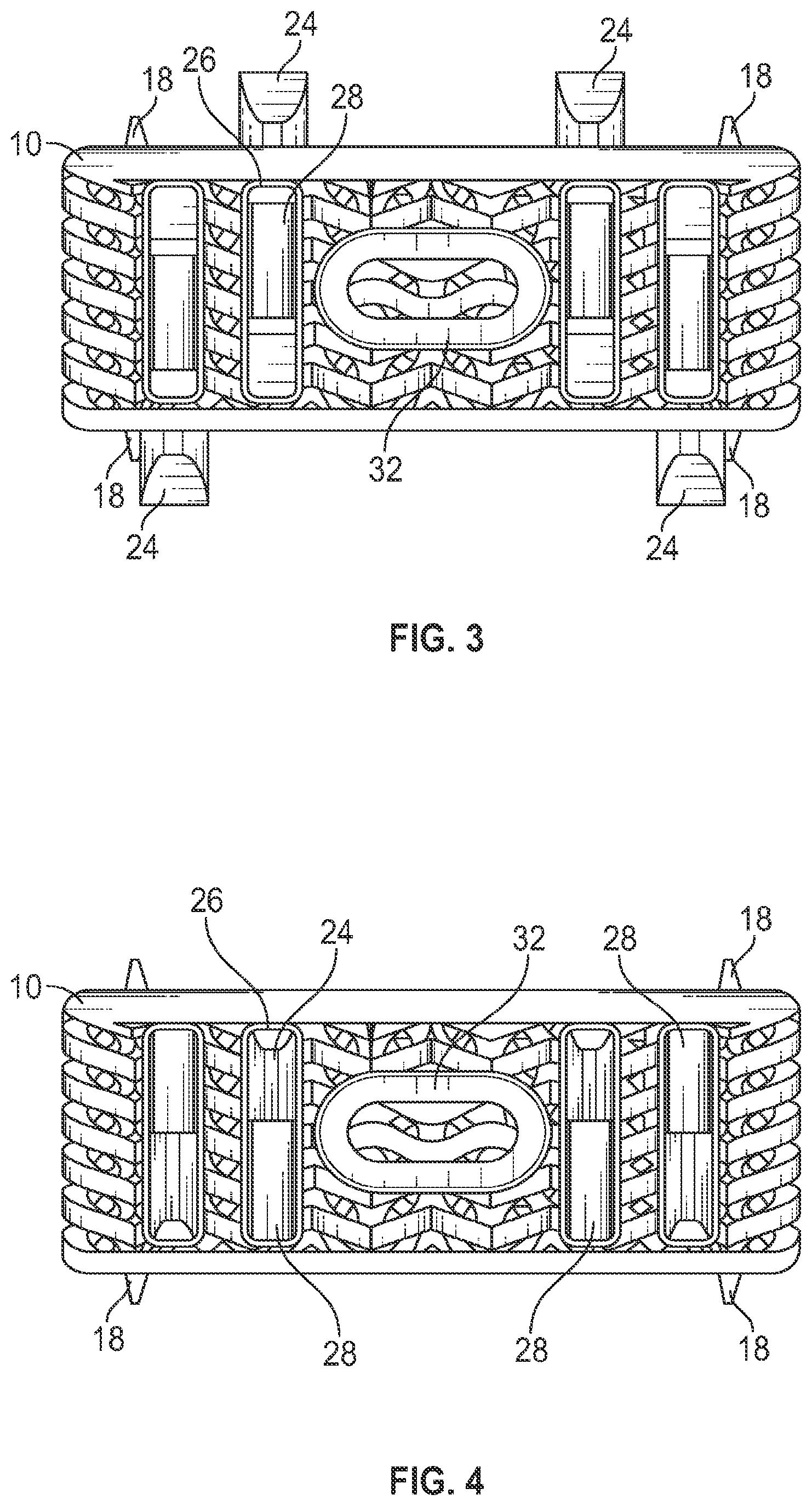 Patent US12616585 Figure 2 – Stand-alone interbody fusion