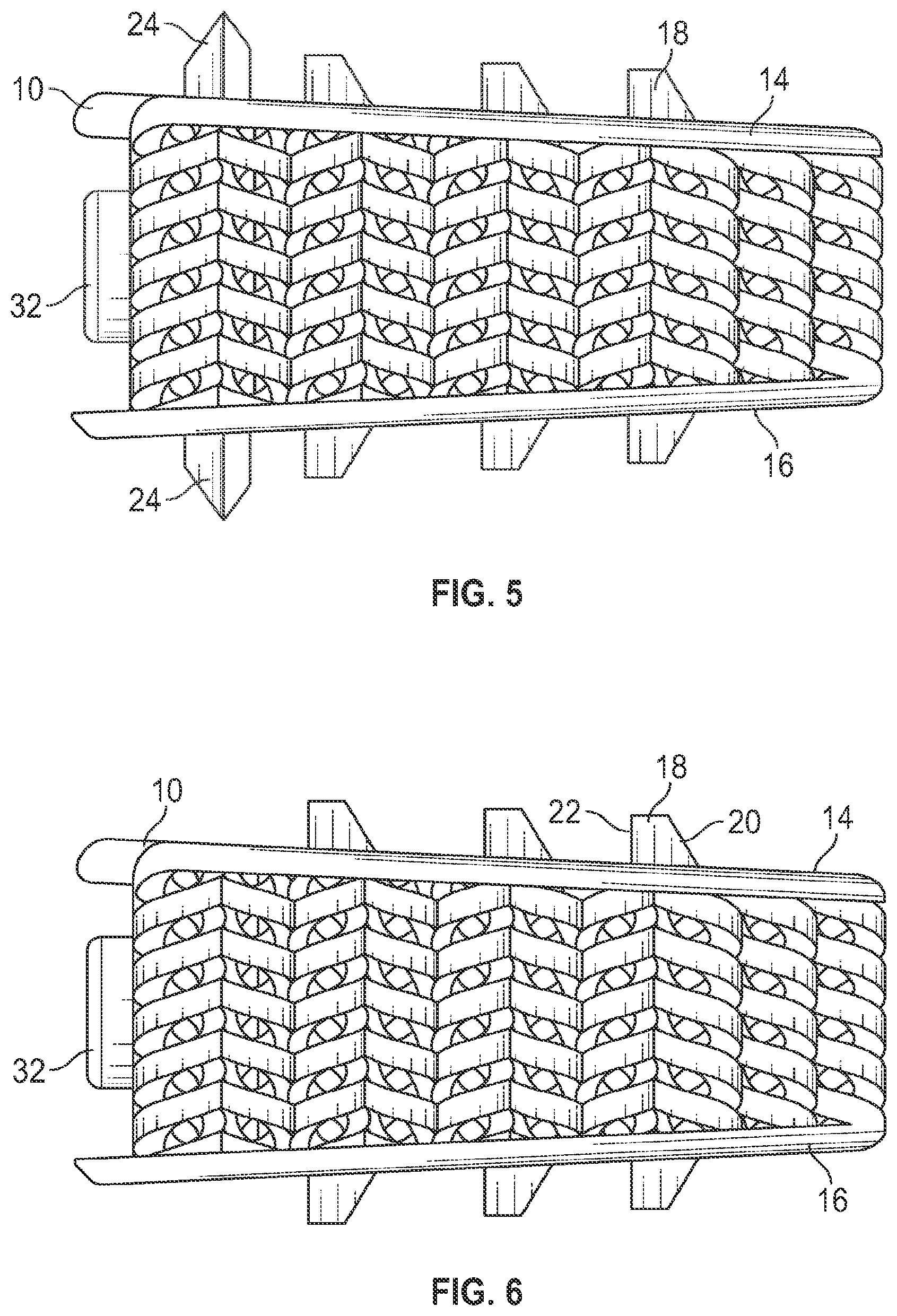Patent US12616585 Figure 3 – Stand-alone interbody fusion