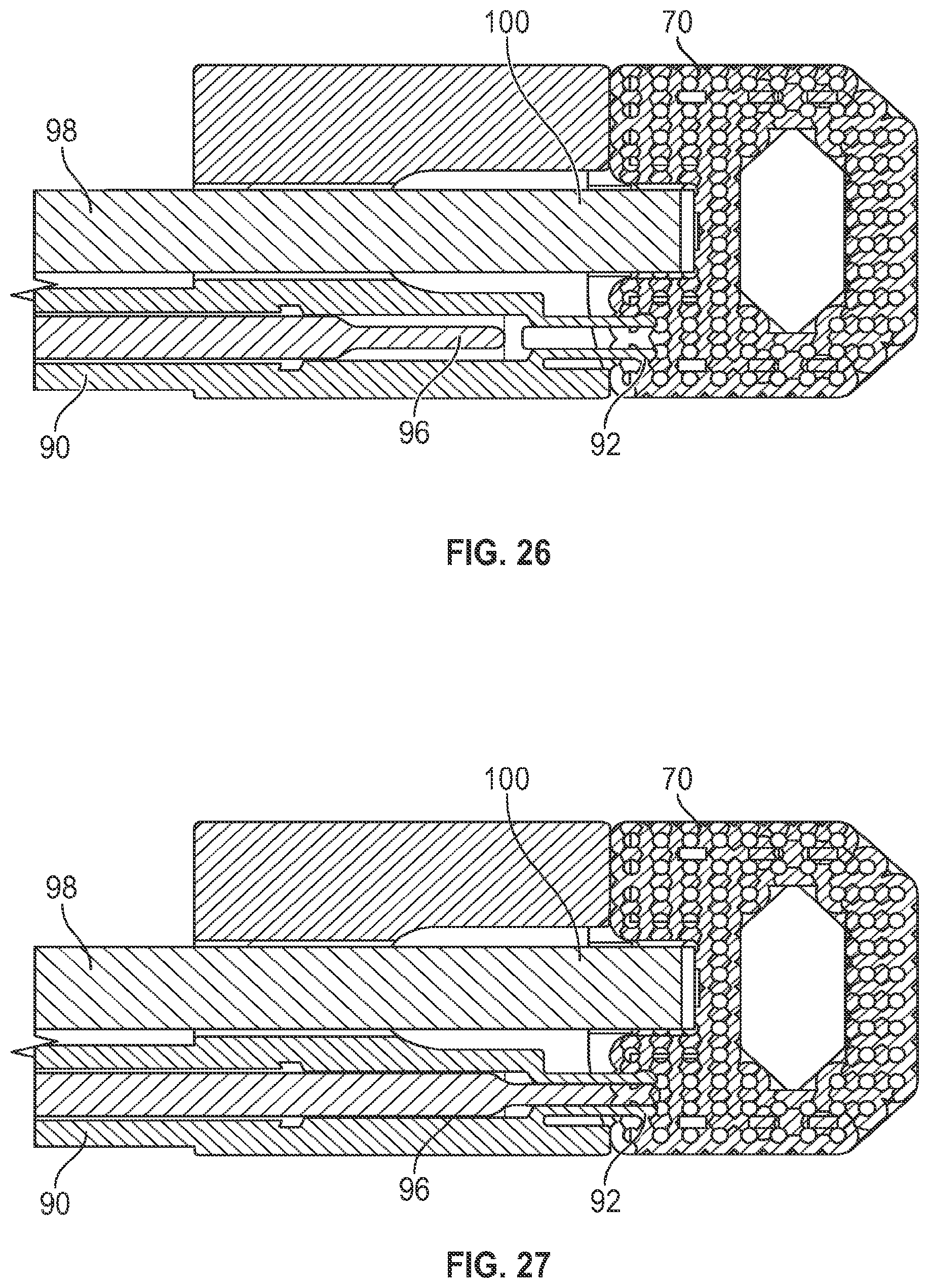 Patent US12616585 Figure 13 – Stand-alone interbody fusion