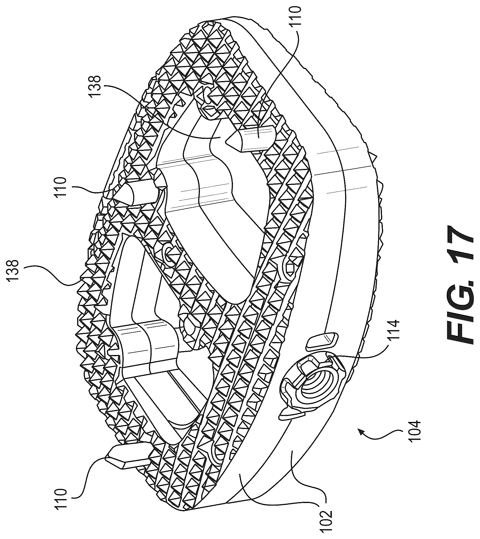 Patent US12616586 Figure 15 – Stabilized intervertebral spacer