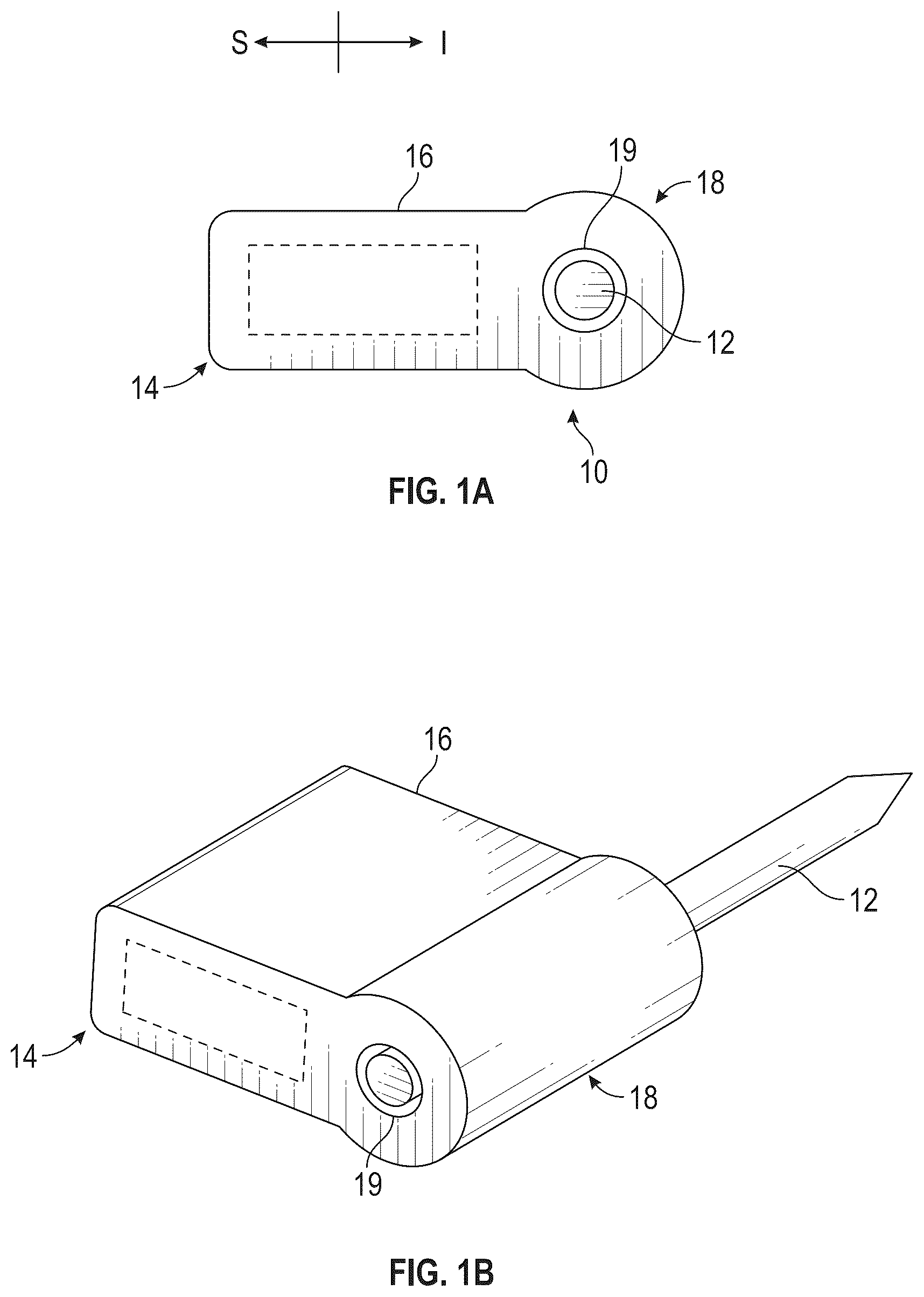 Patent US12616587 — Sacro-iliac joint stabilizing implants and methods of implantation — Figure 1