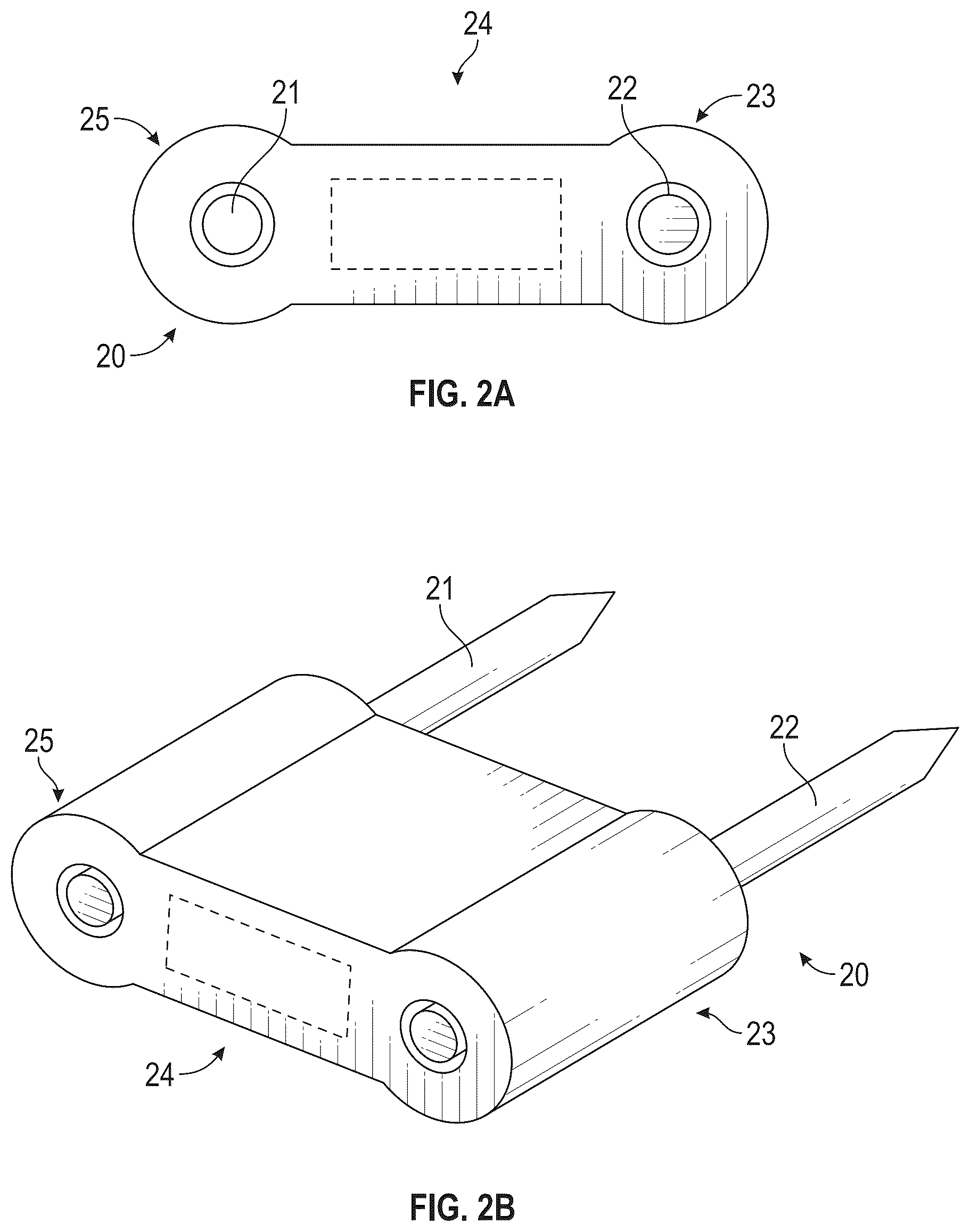 Patent US12616587 Figure 2 – Sacro-iliac joint stabilizing implants and methods of implantation
