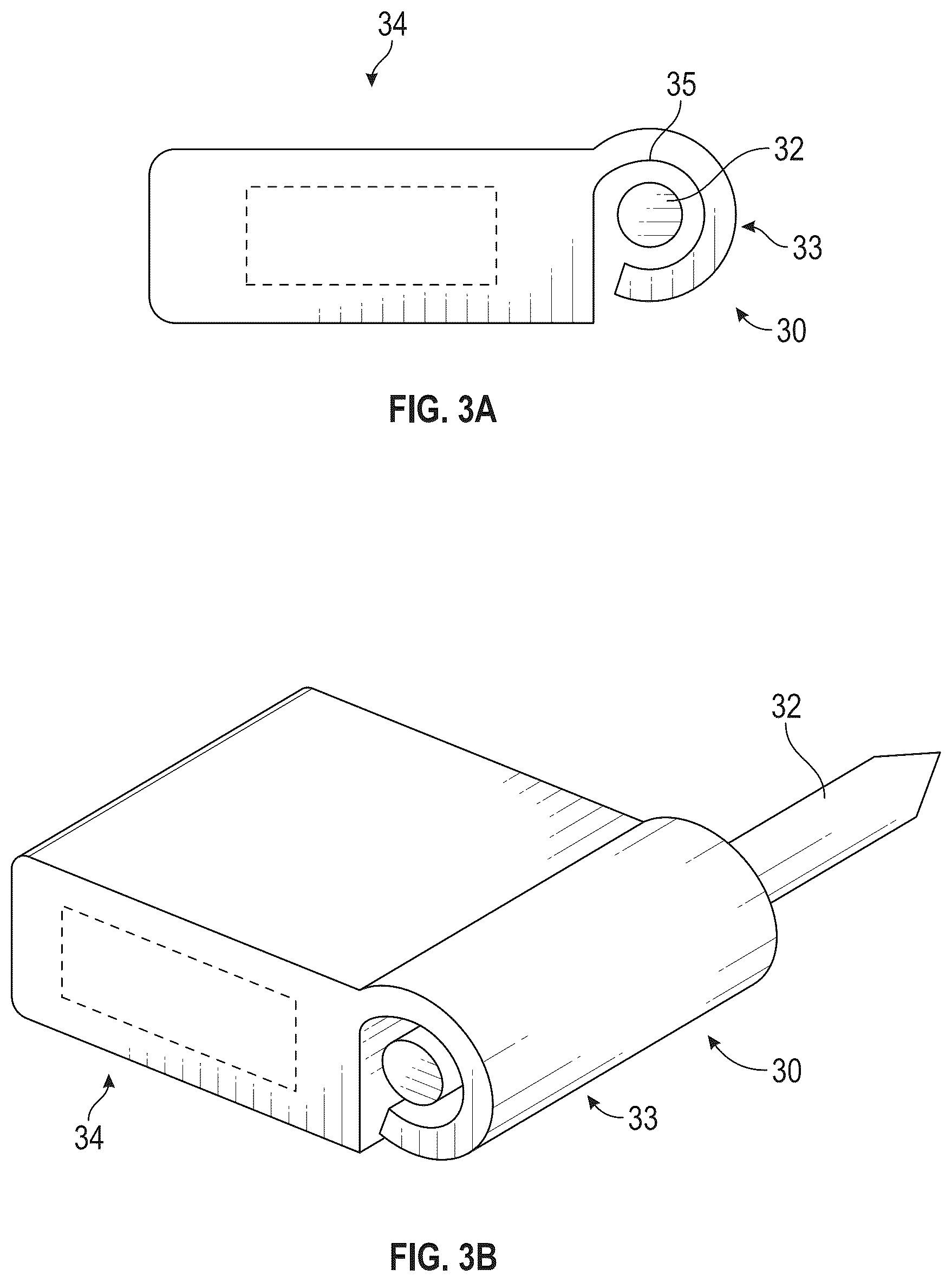 Patent US12616587 Figure 3 – Sacro-iliac joint stabilizing implants and methods of implantation