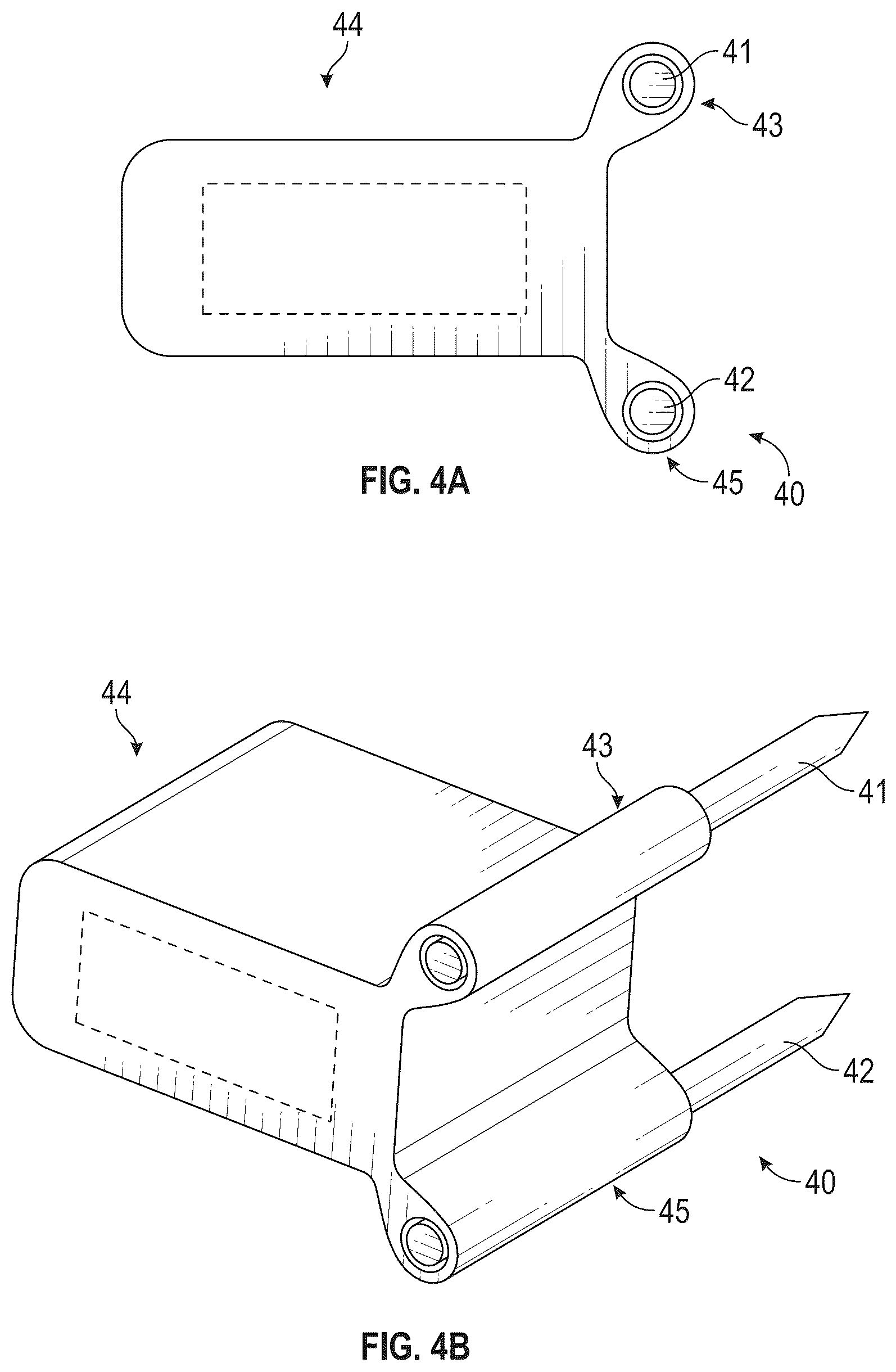 Patent US12616587 Figure 4 – Sacro-iliac joint stabilizing implants and methods of implantation