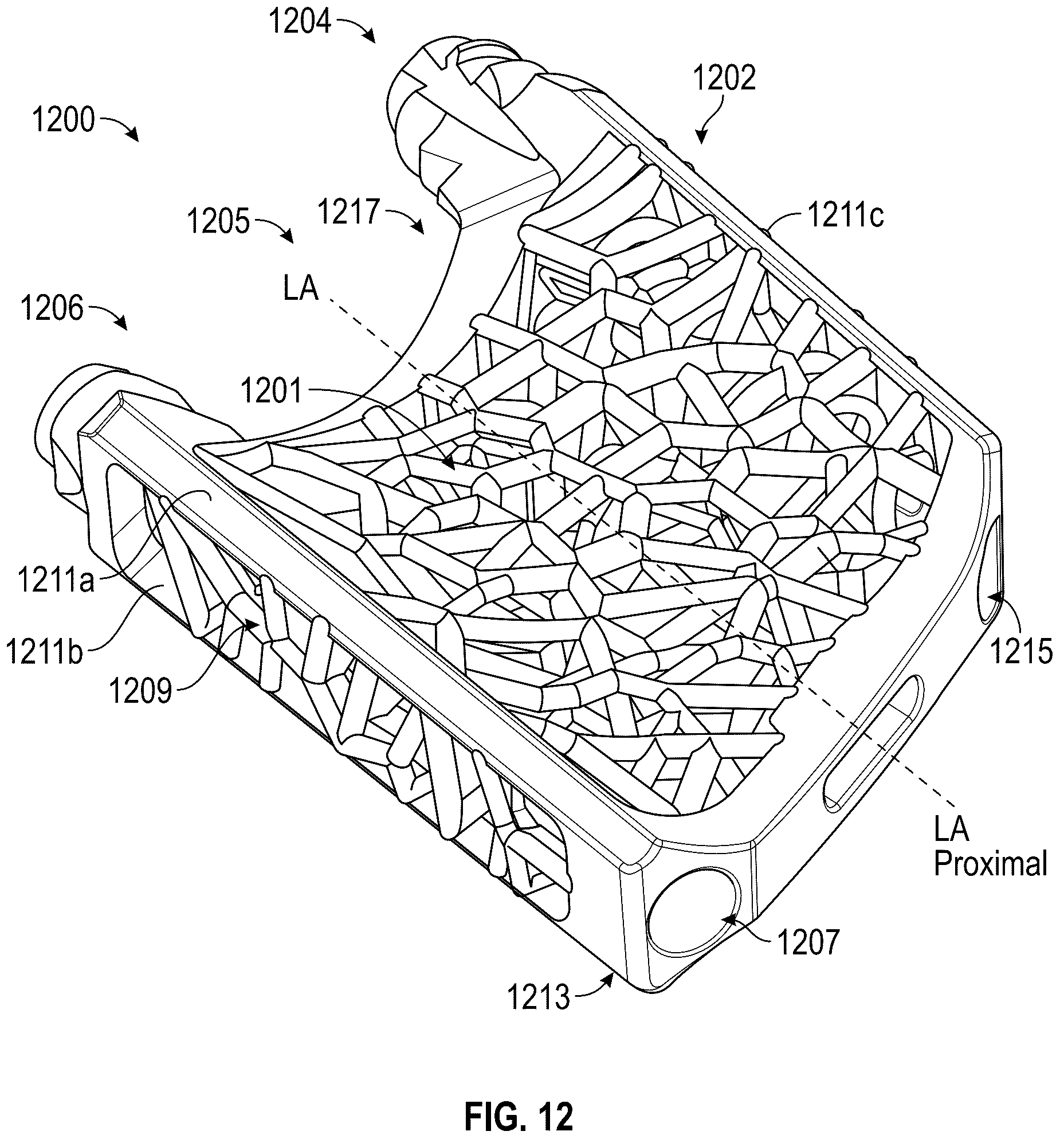Patent US12616587 Figure 10 – Sacro-iliac joint stabilizing implants and methods of implantation