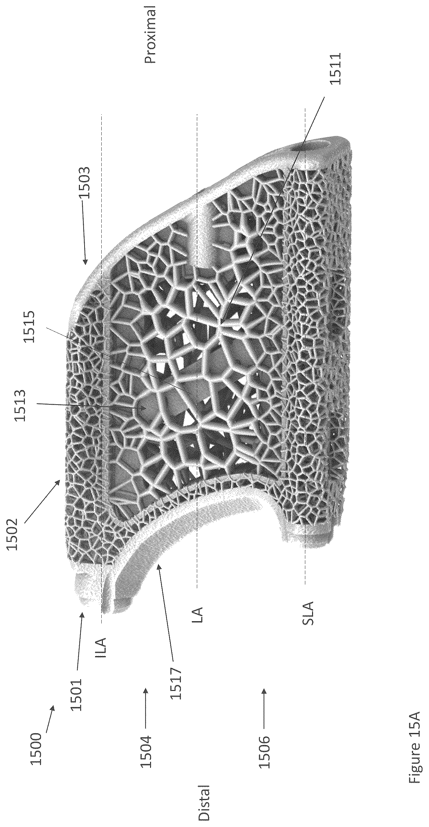 Patent US12616587 Figure 13 – Sacro-iliac joint stabilizing implants and methods of implantation