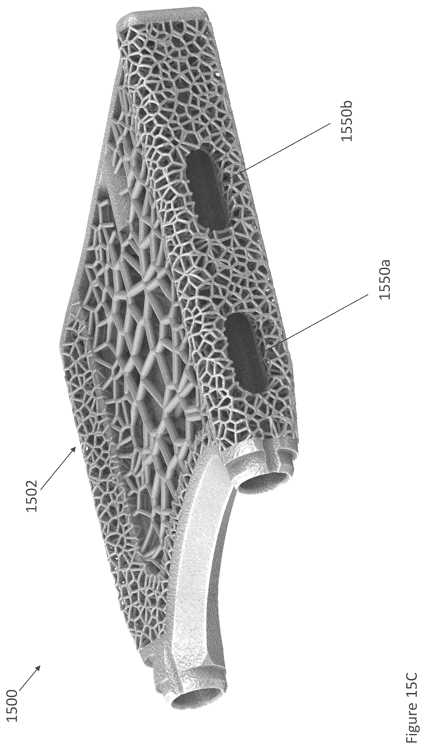 Patent US12616587 Figure 15 – Sacro-iliac joint stabilizing implants and methods of implantation