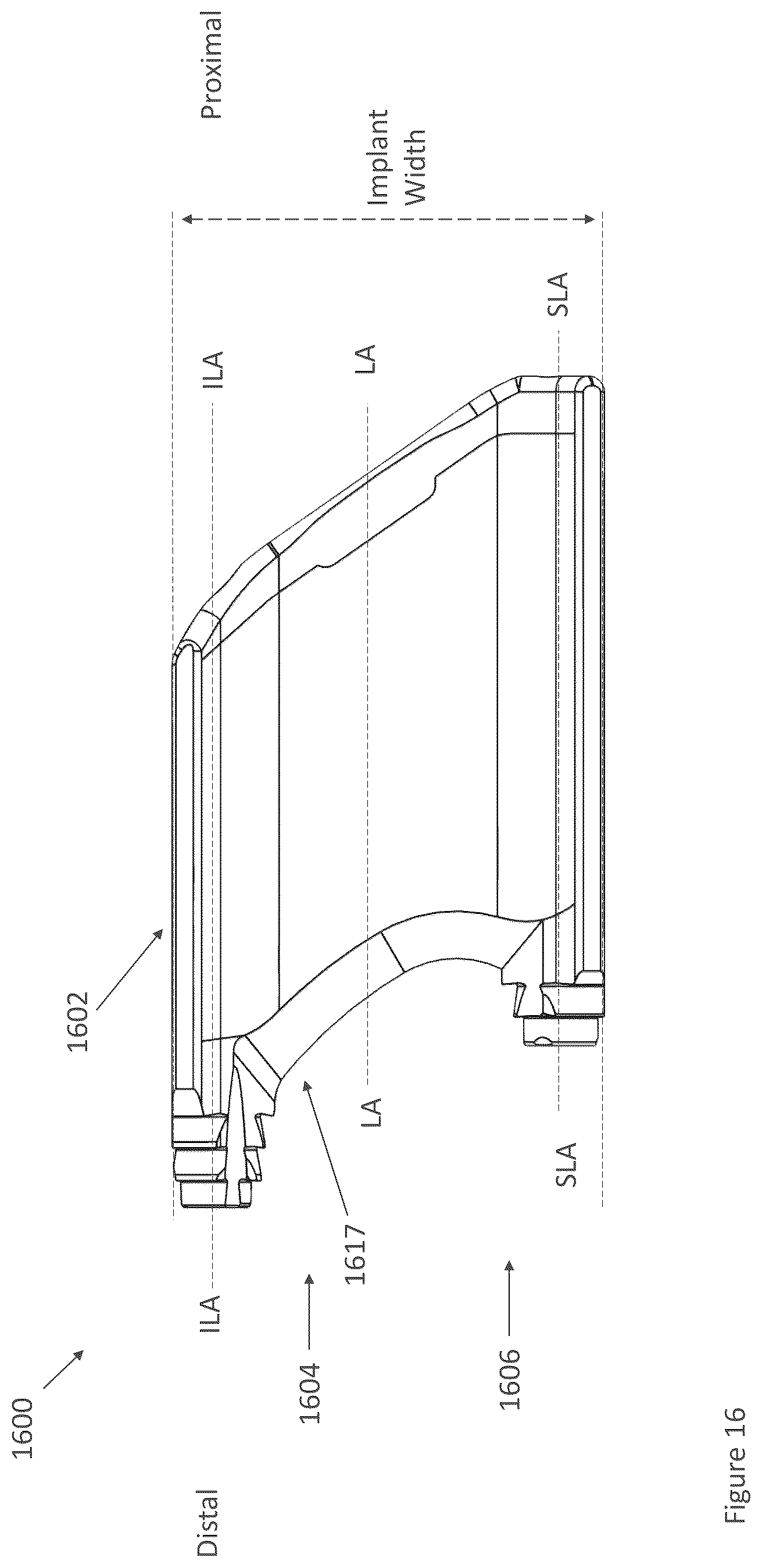 Patent US12616587 Figure 16 – Sacro-iliac joint stabilizing implants and methods of implantation
