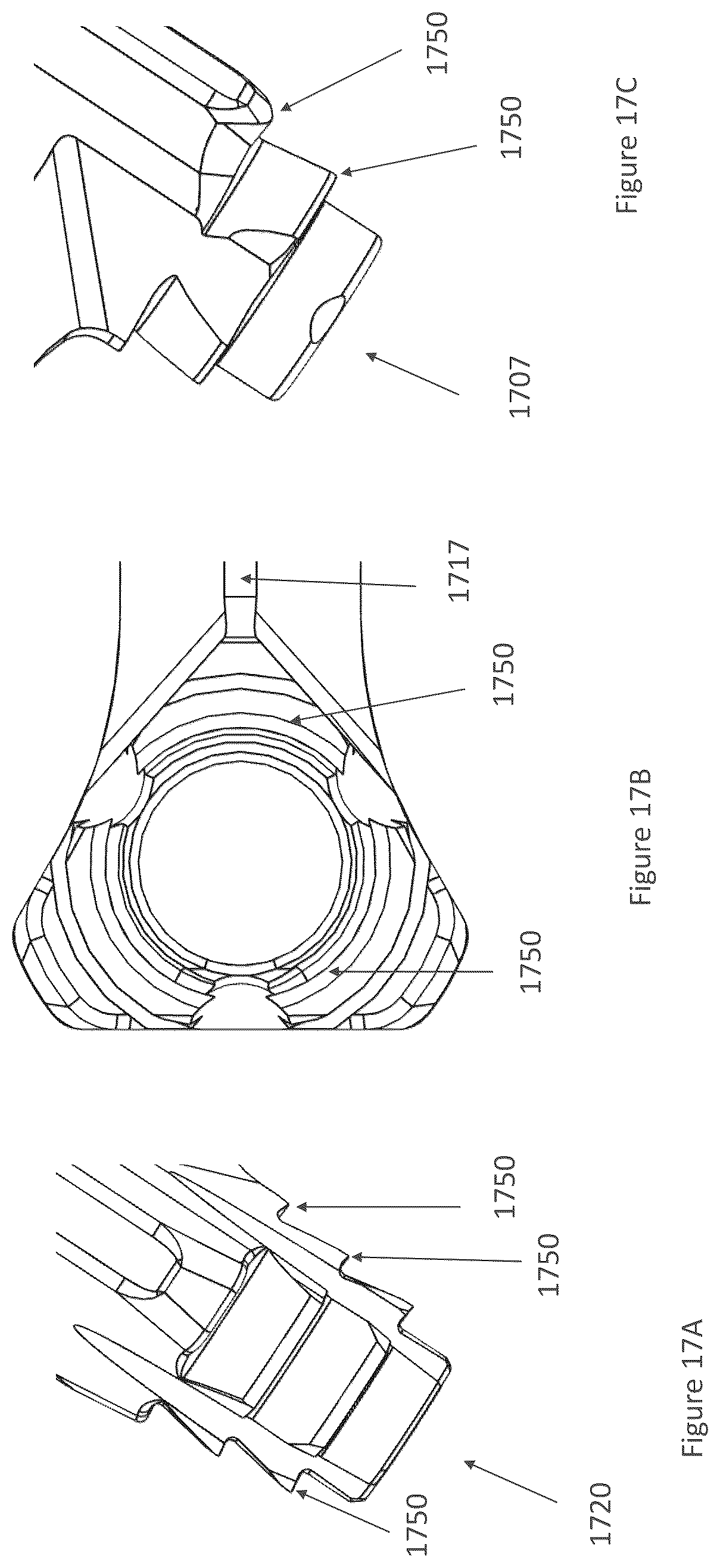 Patent US12616587 Figure 17 – Sacro-iliac joint stabilizing implants and methods of implantation