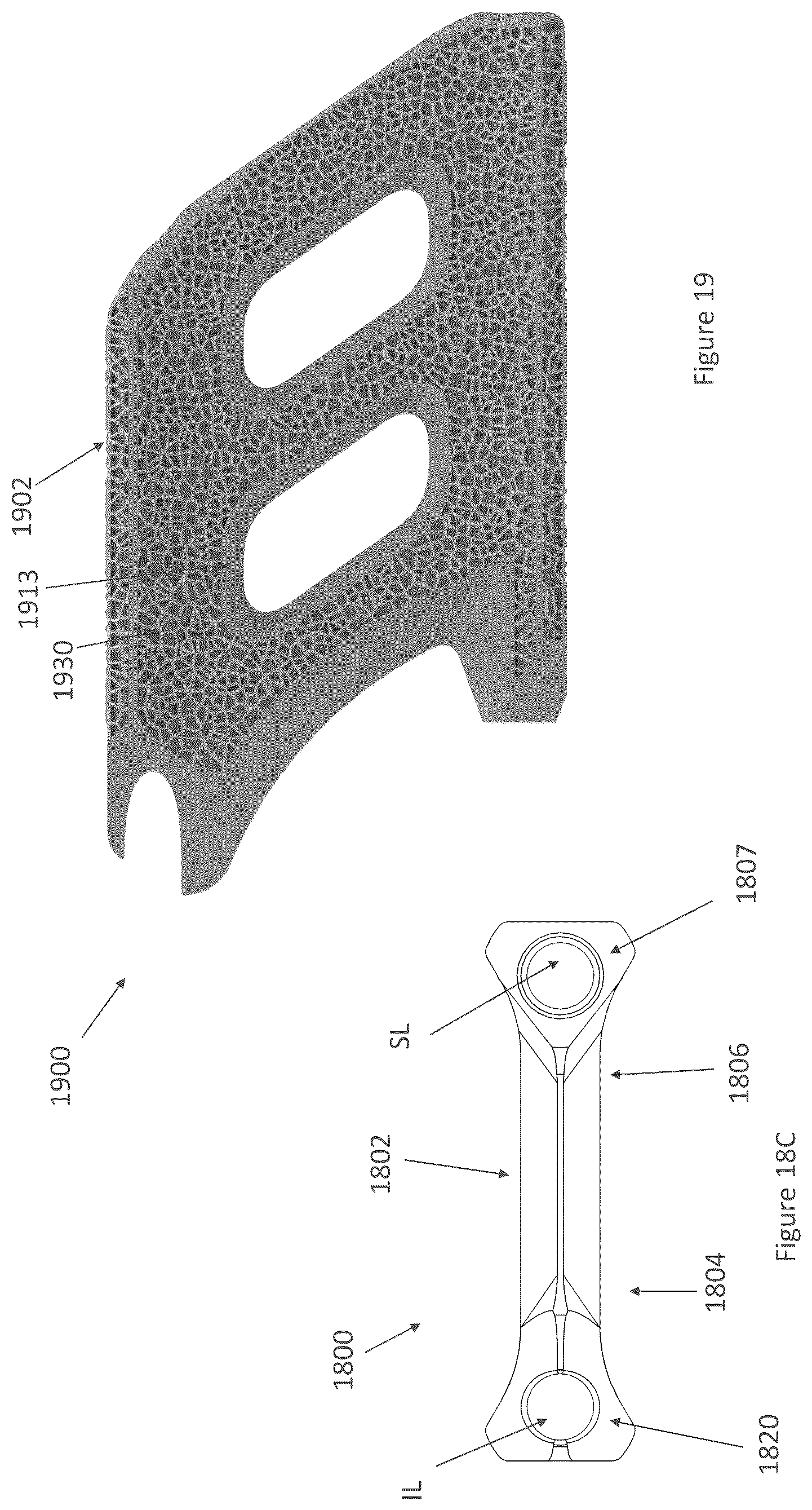 Patent US12616587 Figure 19 – Sacro-iliac joint stabilizing implants and methods of implantation
