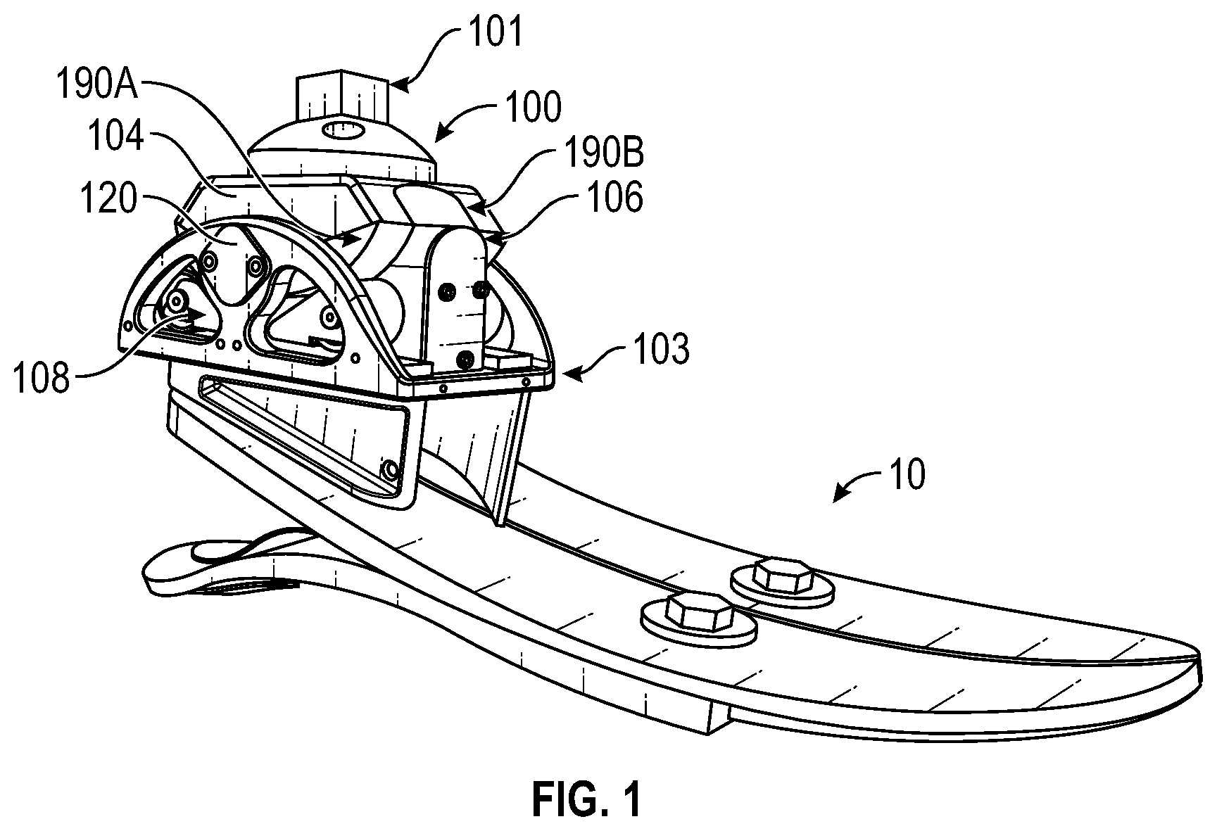 Patent US12616589 Figure 1 – Systems and methods for an ankle prosthesis