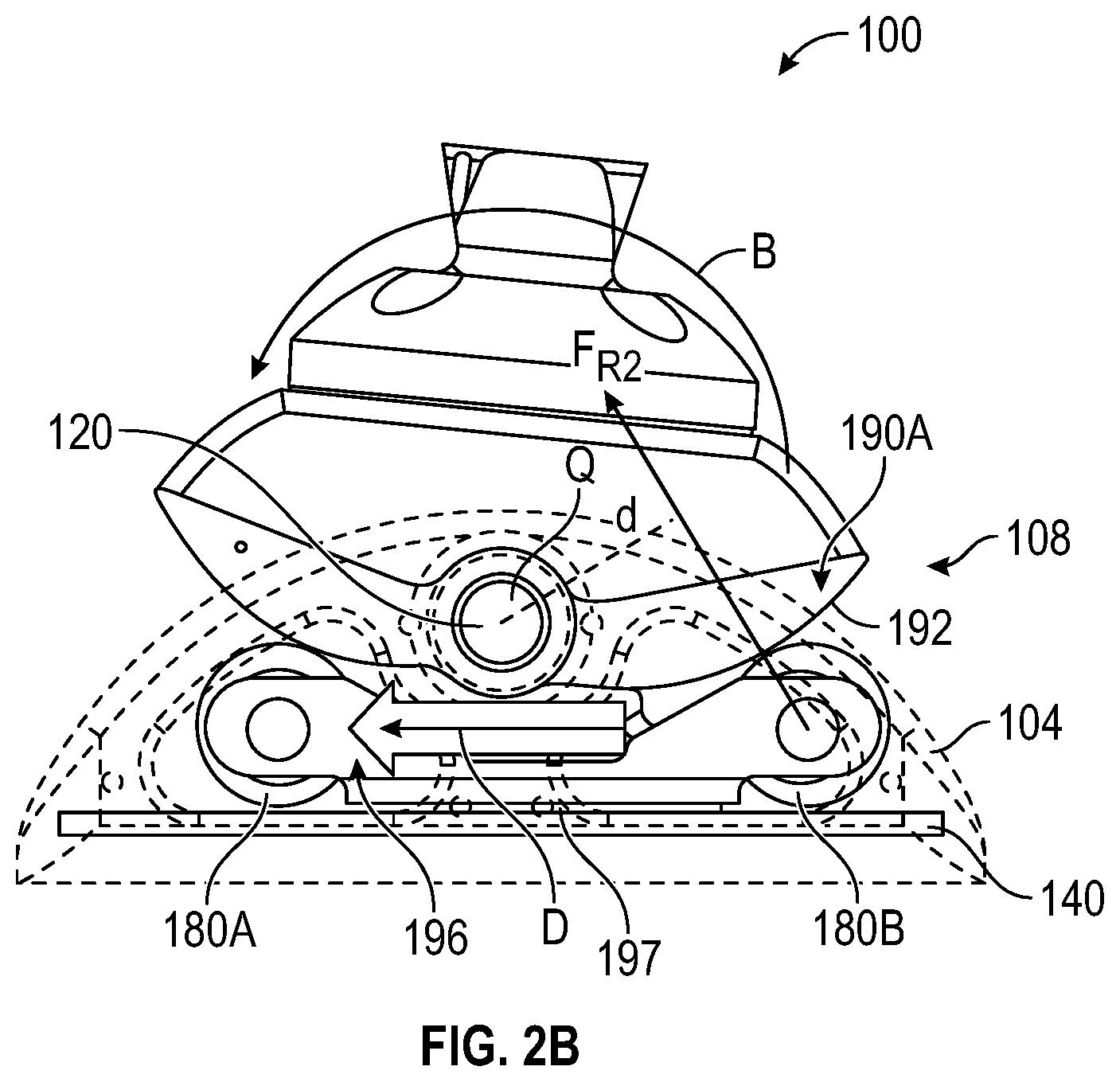 Patent US12616589 Figure 3 – Systems and methods for an ankle prosthesis