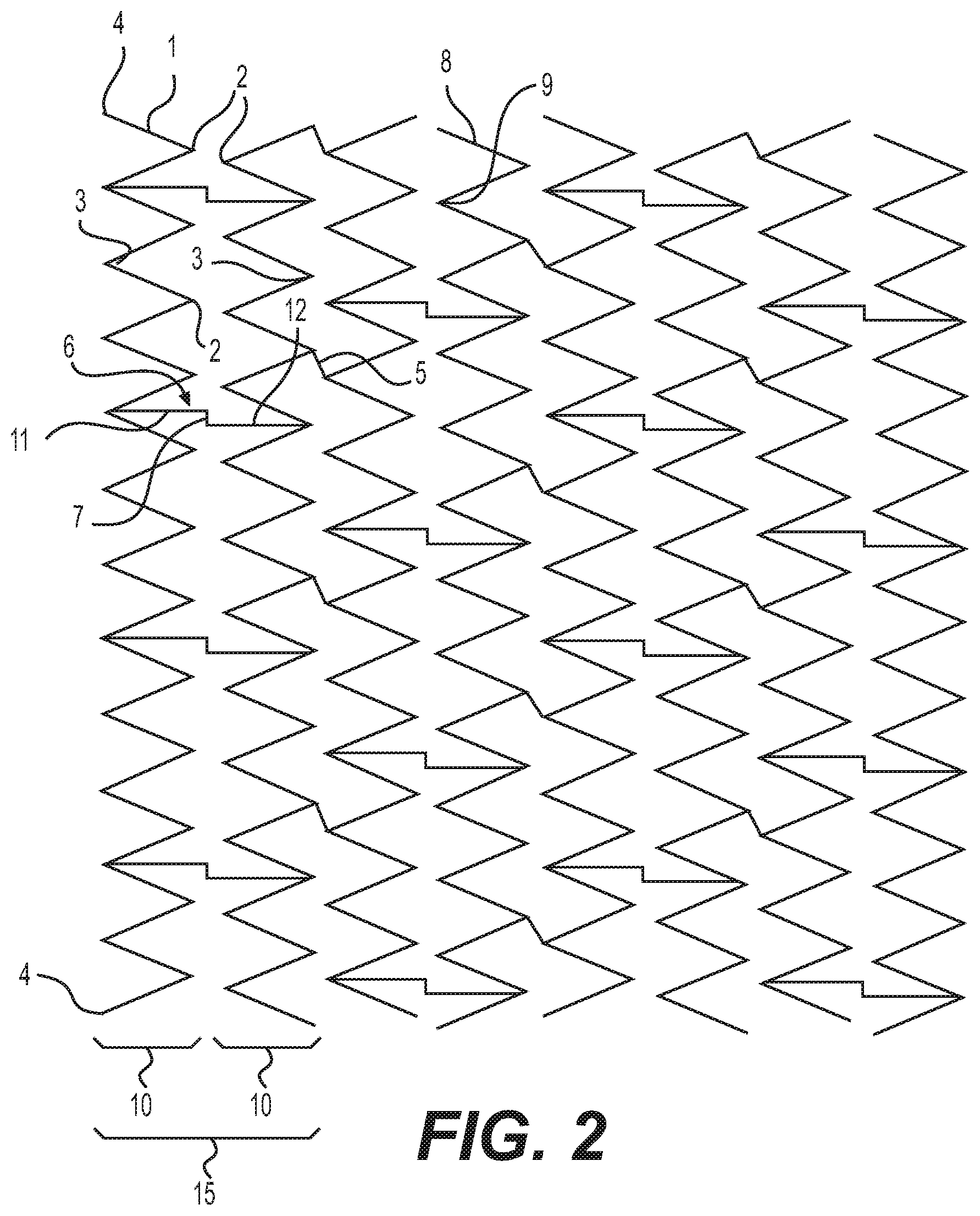 Patent US12616592 Figure 2 – Bidirectional stent and method of use thereof