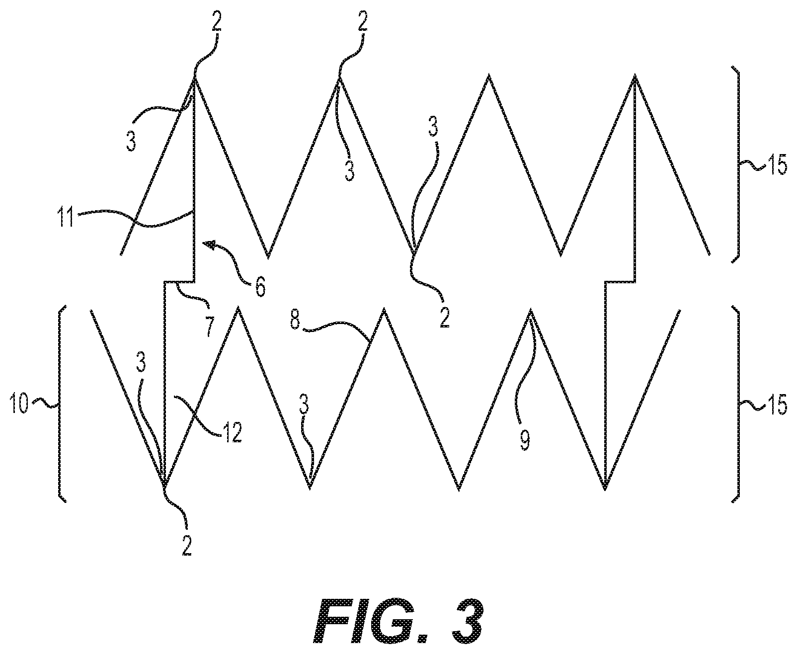 Patent US12616592 Figure 3 – Bidirectional stent and method of use thereof