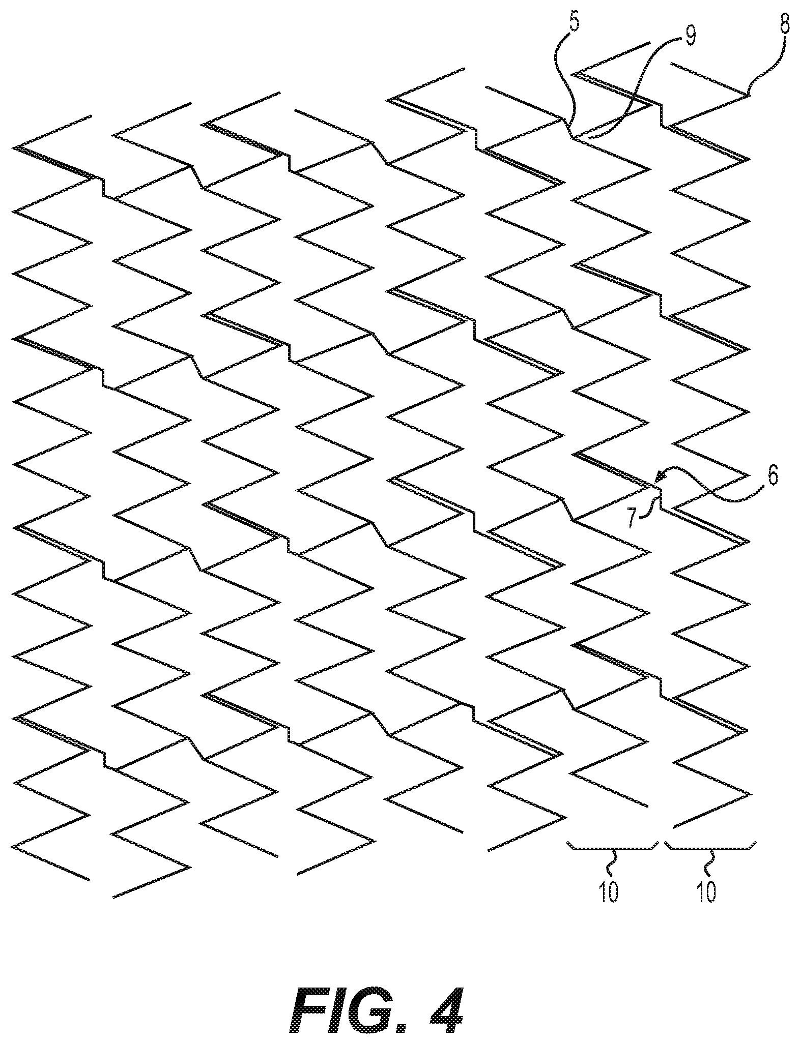 Patent US12616592 Figure 4 – Bidirectional stent and method of use thereof