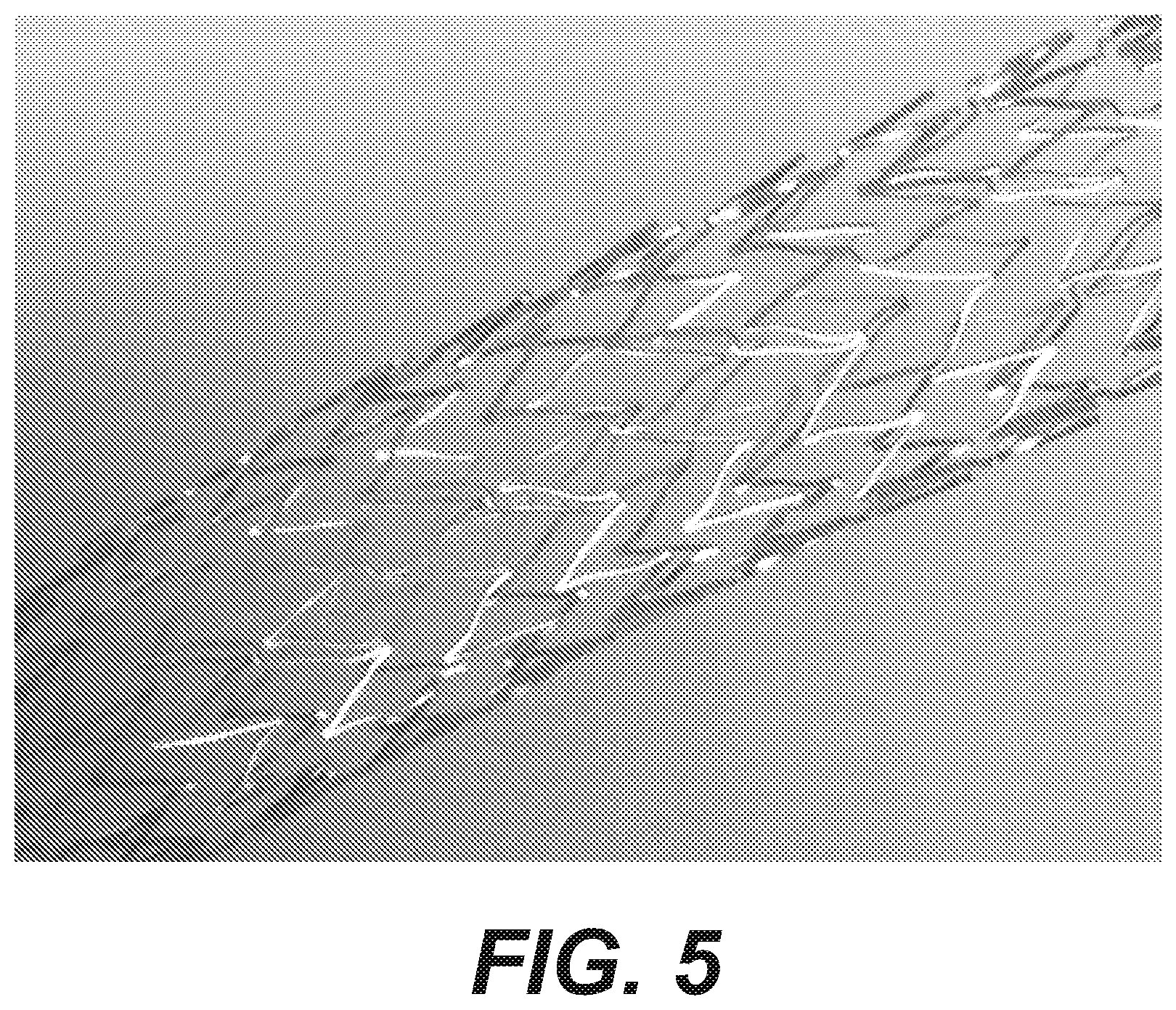 Patent US12616592 Figure 5 – Bidirectional stent and method of use thereof