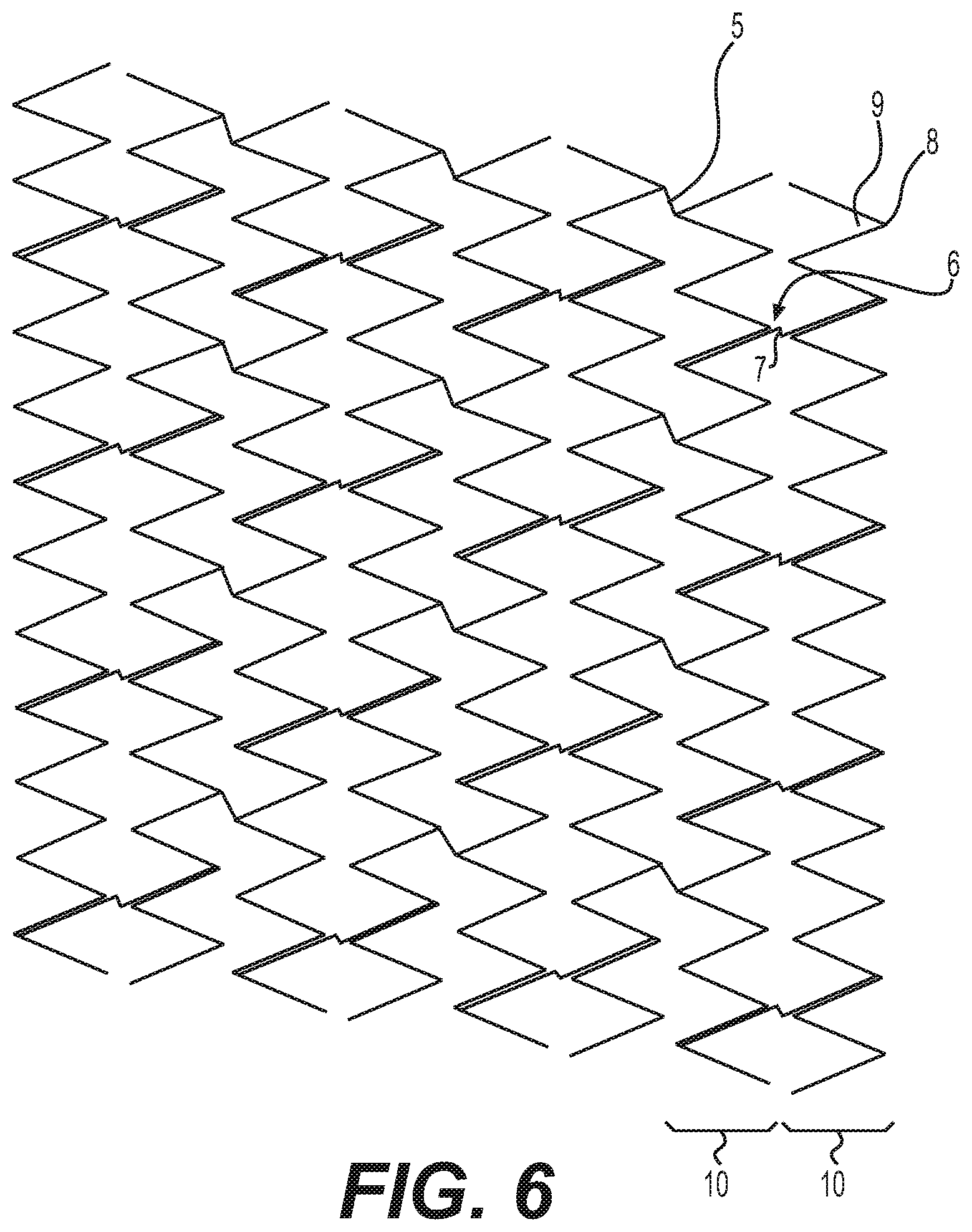 Patent US12616592 Figure 6 – Bidirectional stent and method of use thereof