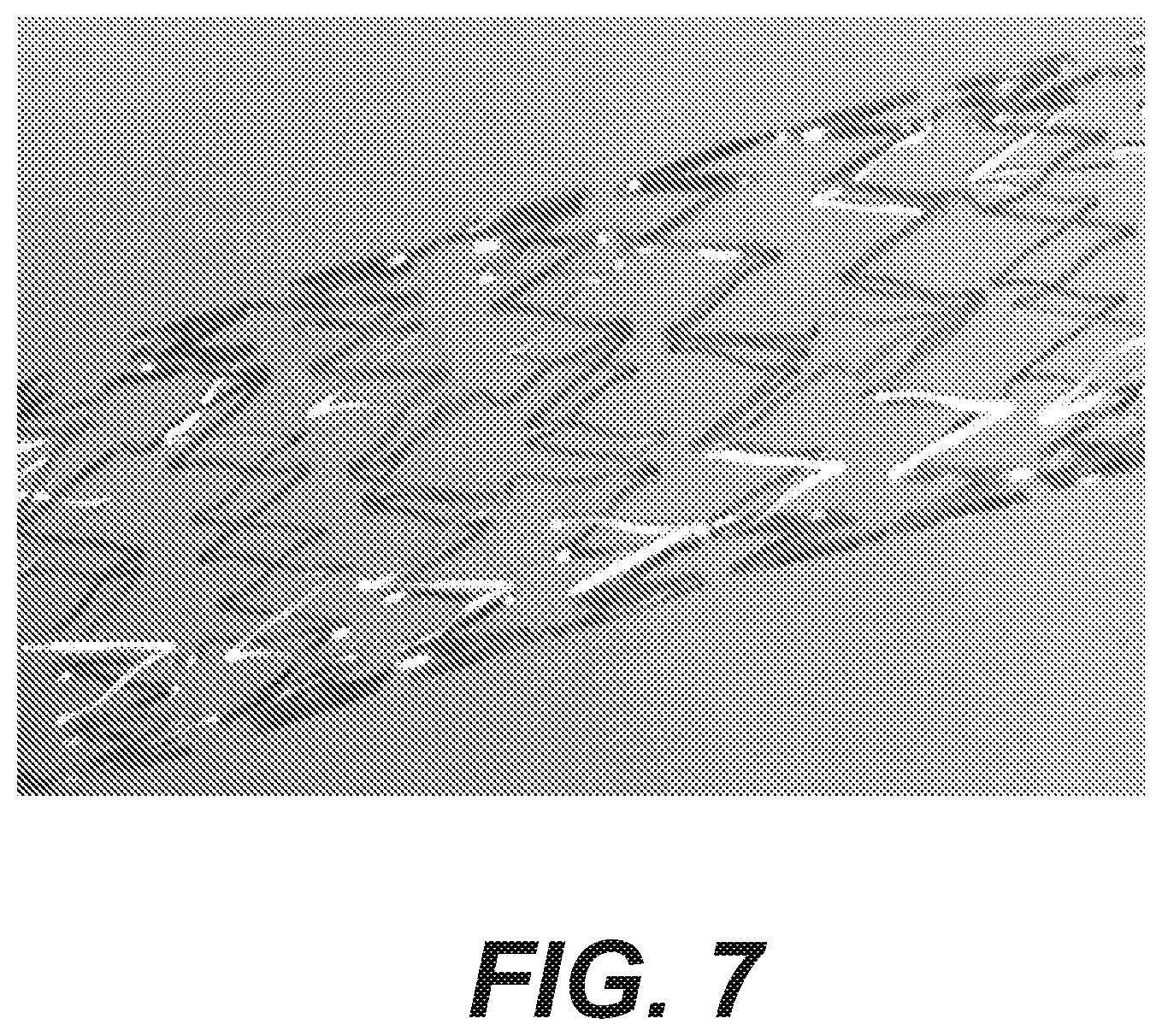 Patent US12616592 Figure 7 – Bidirectional stent and method of use thereof