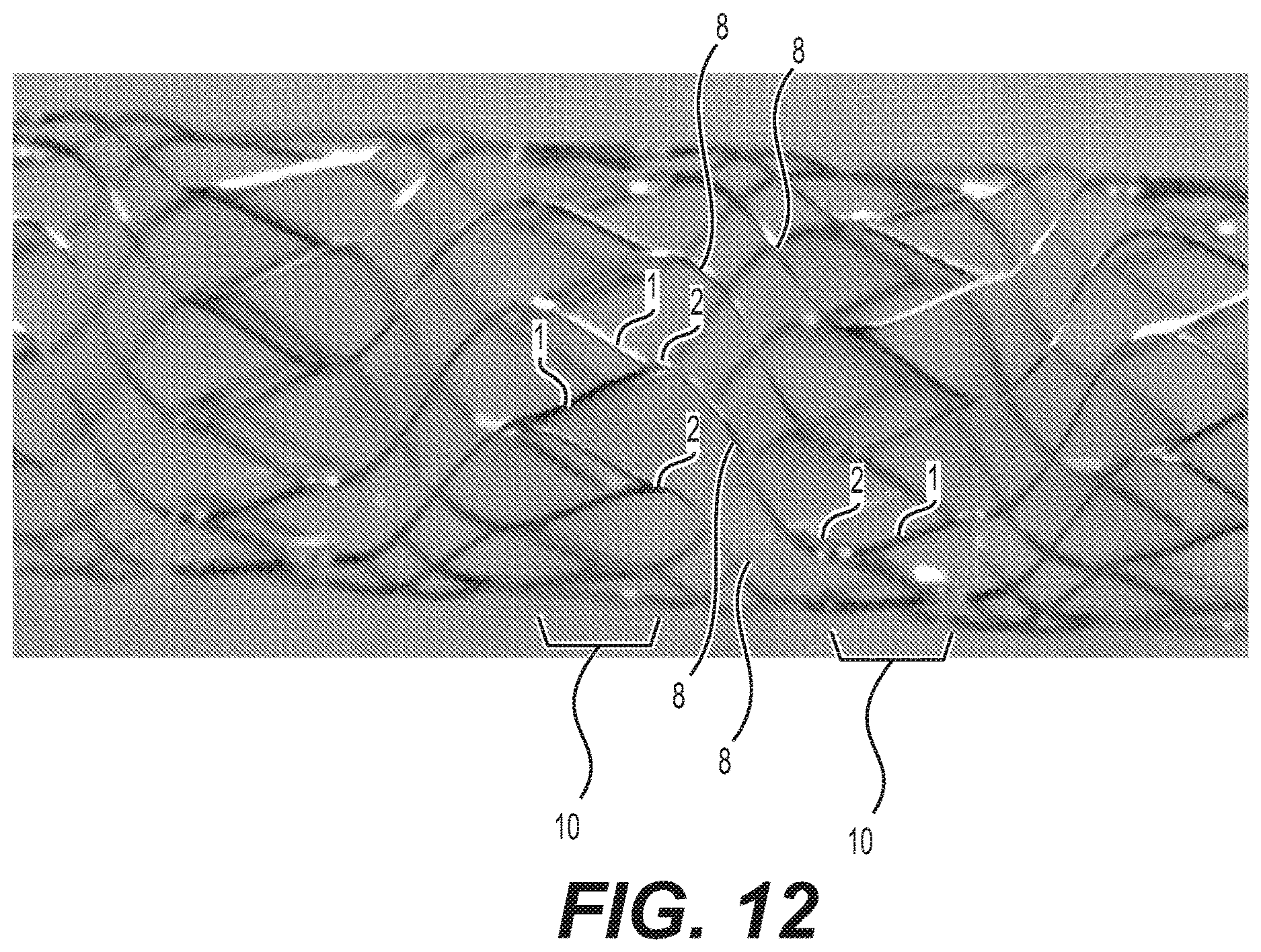 Patent US12616592 Figure 13 – Bidirectional stent and method of use thereof