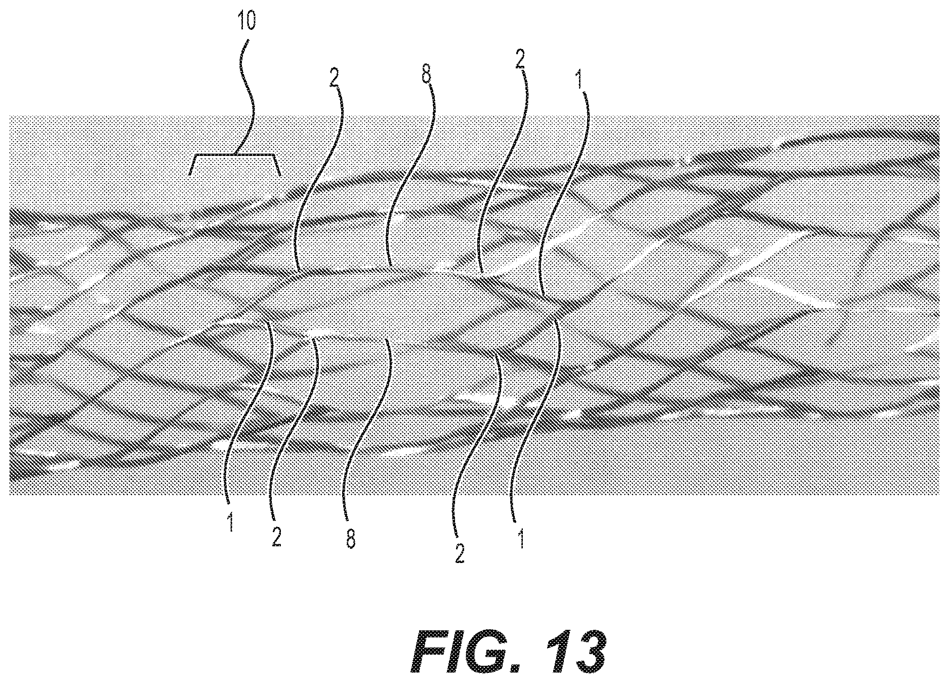 Patent US12616592 Figure 14 – Bidirectional stent and method of use thereof