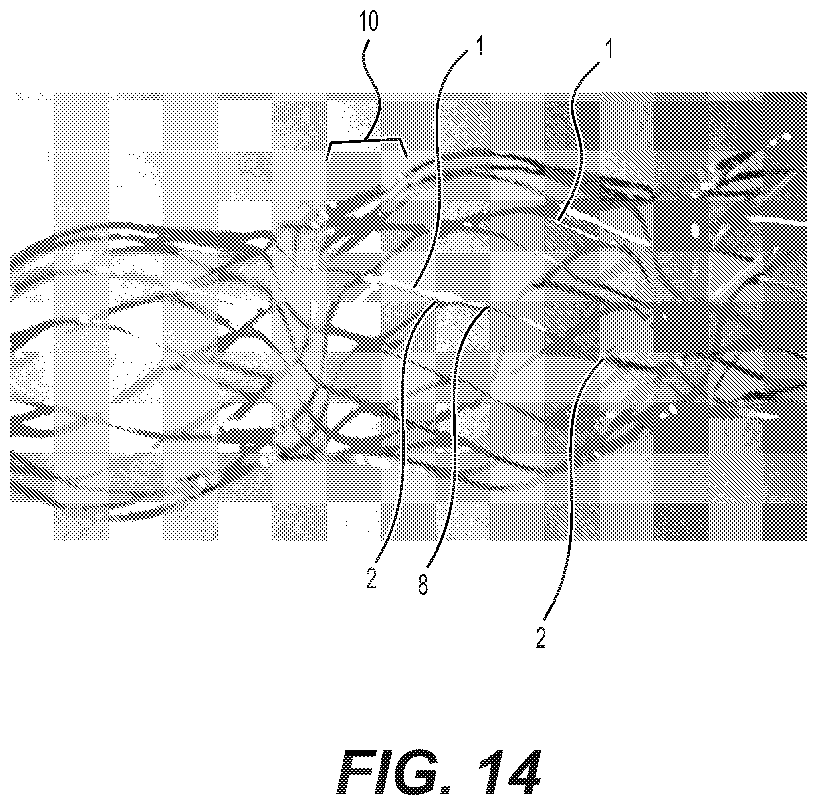 Patent US12616592 Figure 15 – Bidirectional stent and method of use thereof