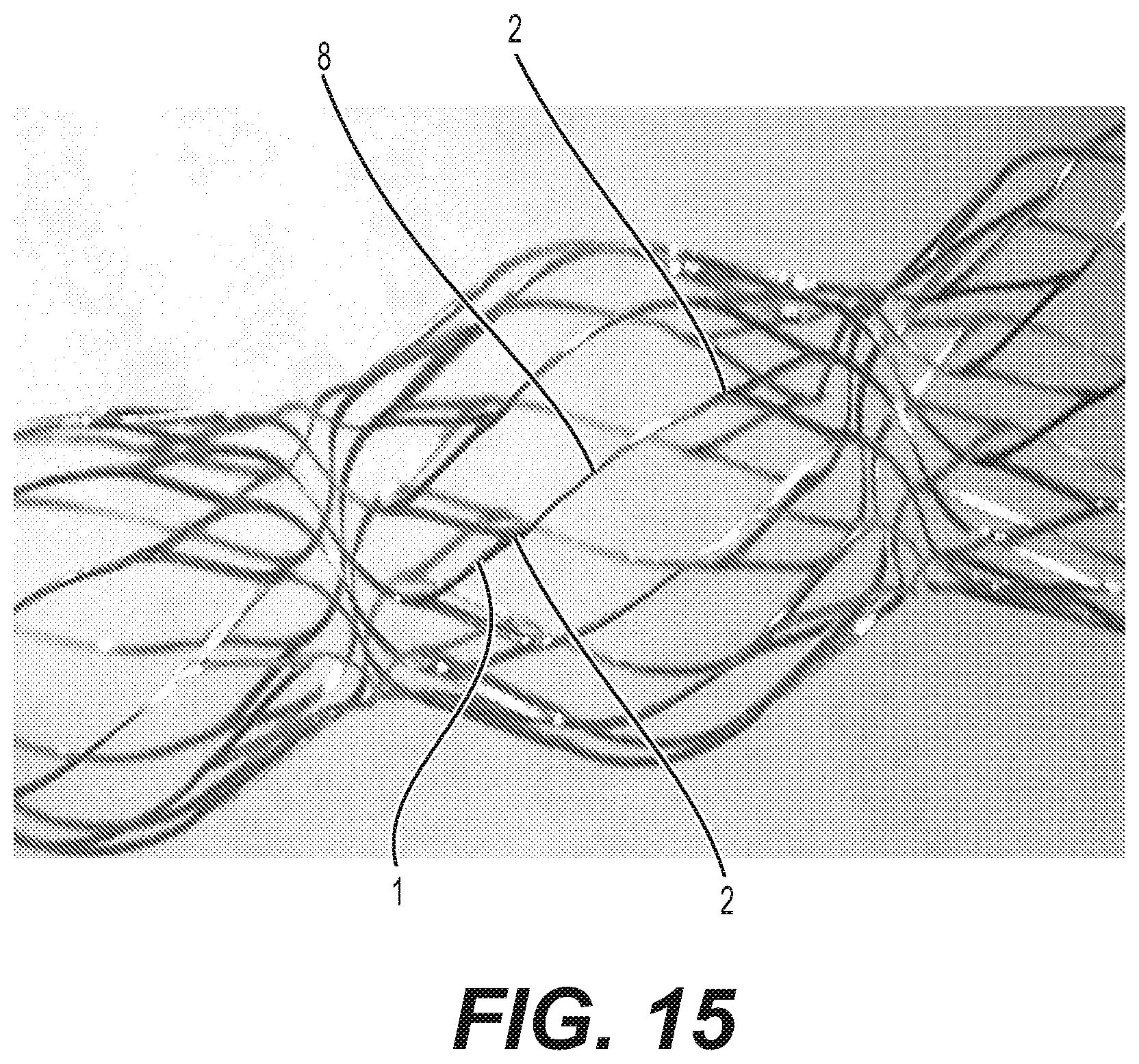 Patent US12616592 Figure 16 – Bidirectional stent and method of use thereof