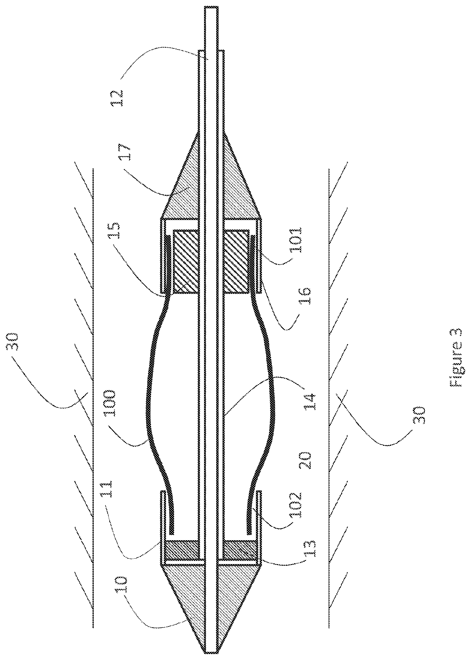 Patent US12616593 Figure 3 – Heart valve prosthesis delivery system and method for delivery of heart valve prosthesis with introducer sheath and loading system