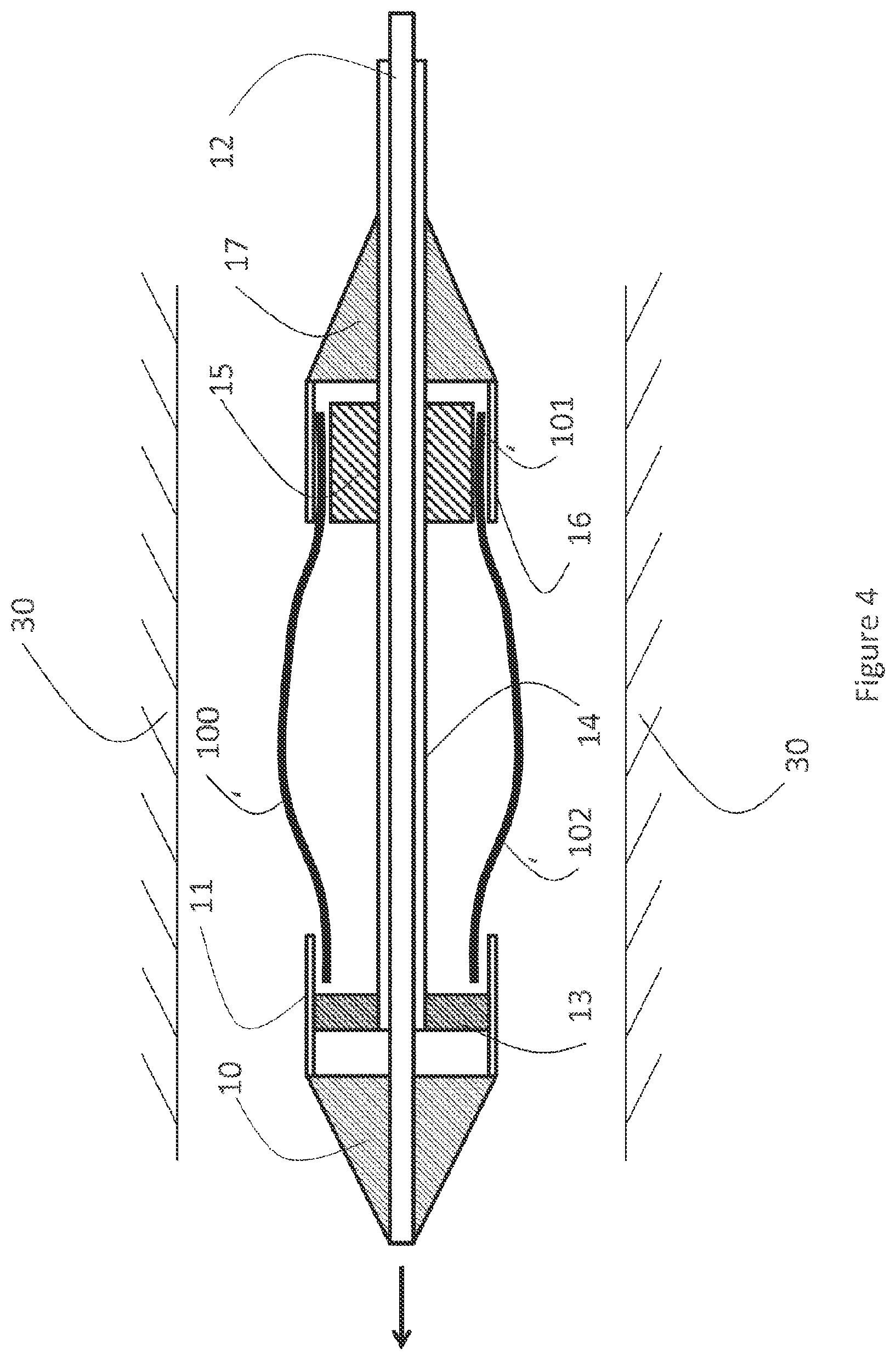 Patent US12616593 Figure 4 – Heart valve prosthesis delivery system and method for delivery of heart valve prosthesis with introducer sheath and loading system