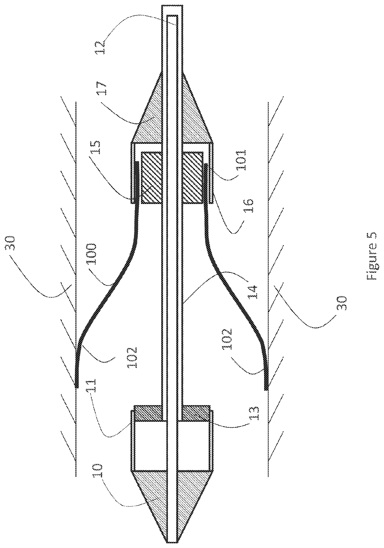 Patent US12616593 Figure 5 – Heart valve prosthesis delivery system and method for delivery of heart valve prosthesis with introducer sheath and loading system
