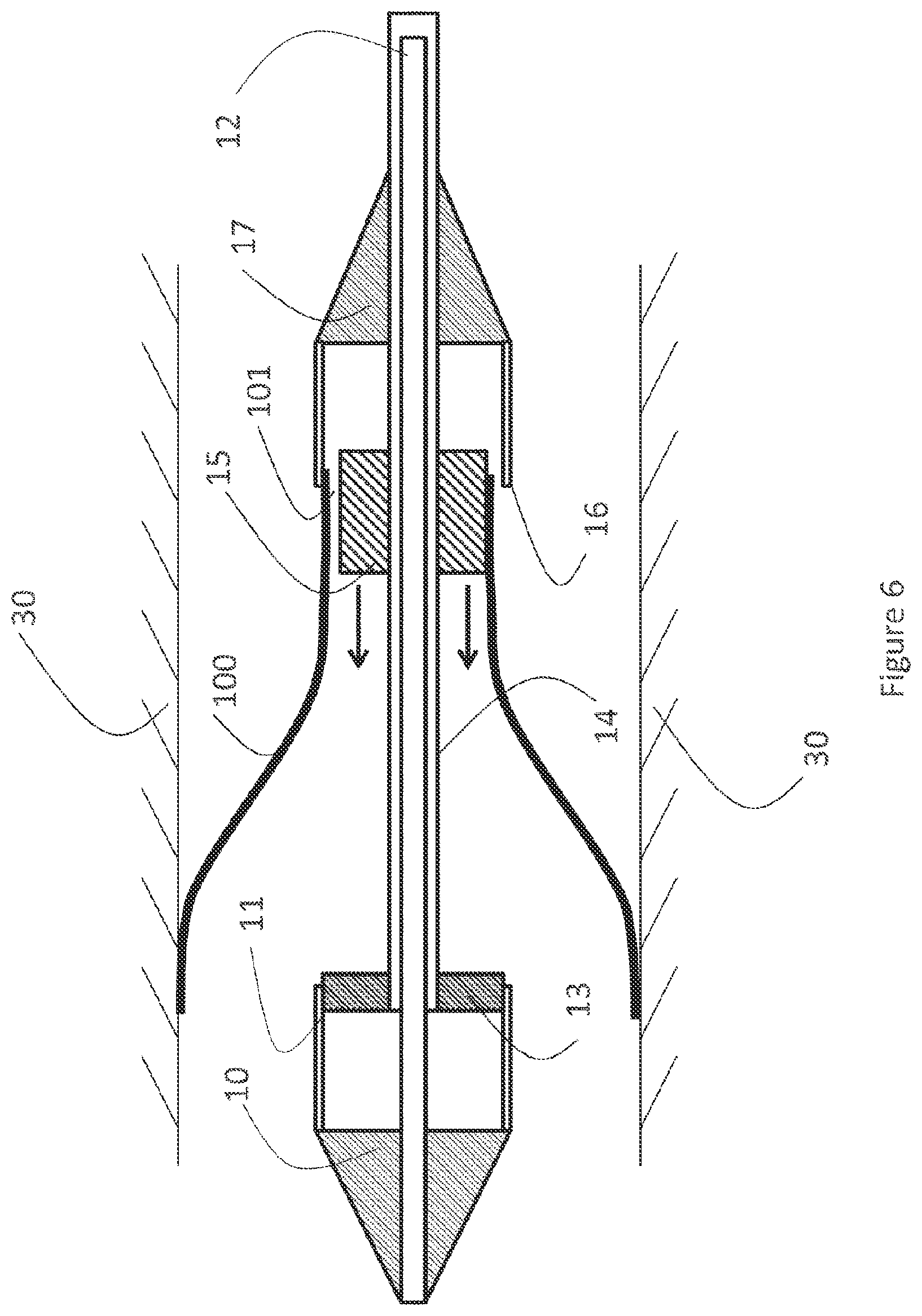 Patent US12616593 Figure 6 – Heart valve prosthesis delivery system and method for delivery of heart valve prosthesis with introducer sheath and loading system