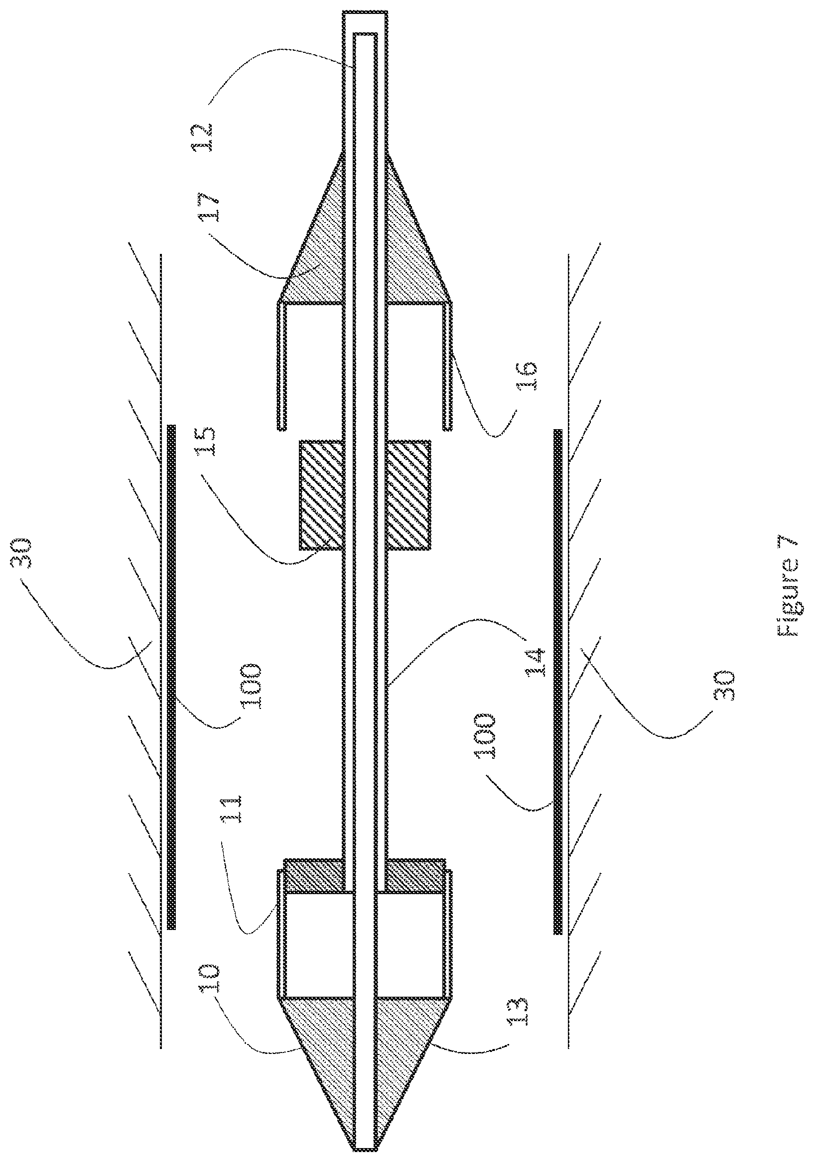 Patent US12616593 Figure 7 – Heart valve prosthesis delivery system and method for delivery of heart valve prosthesis with introducer sheath and loading system