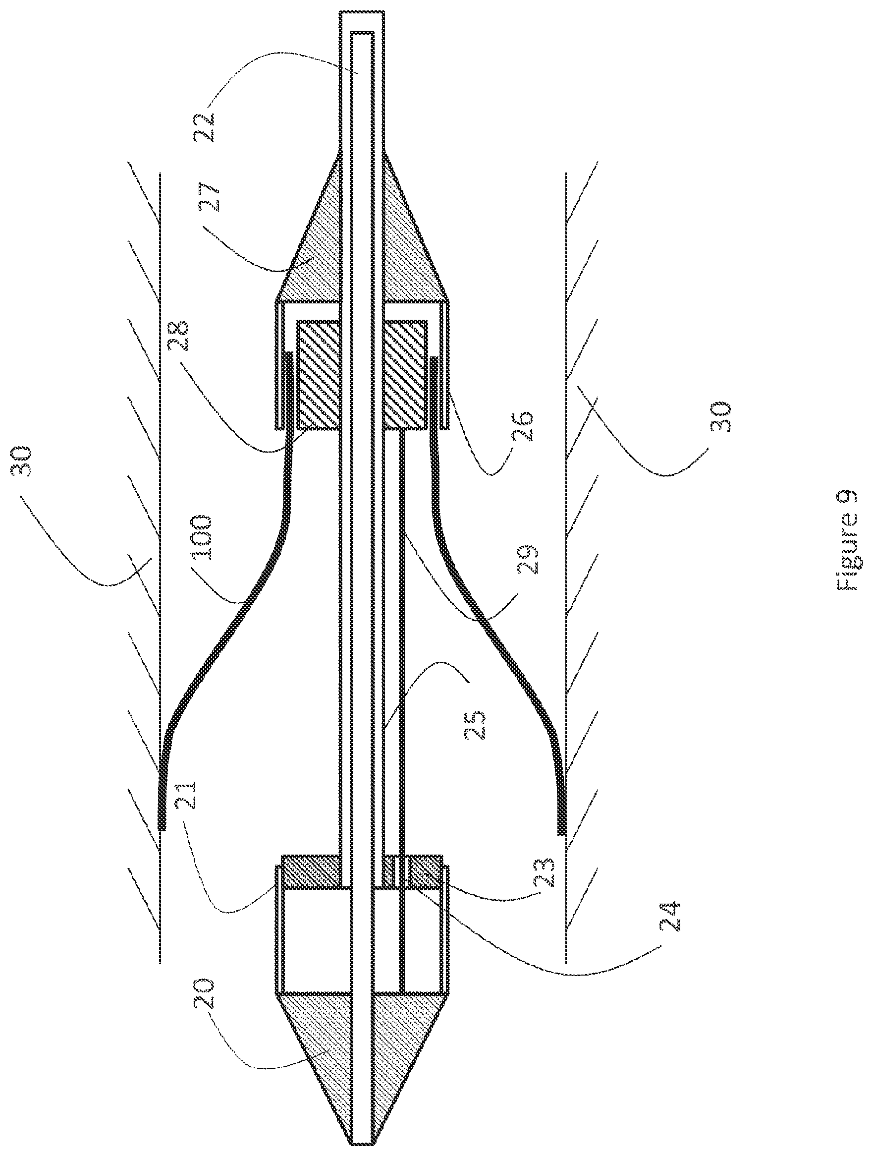Patent US12616593 Figure 9 – Heart valve prosthesis delivery system and method for delivery of heart valve prosthesis with introducer sheath and loading system
