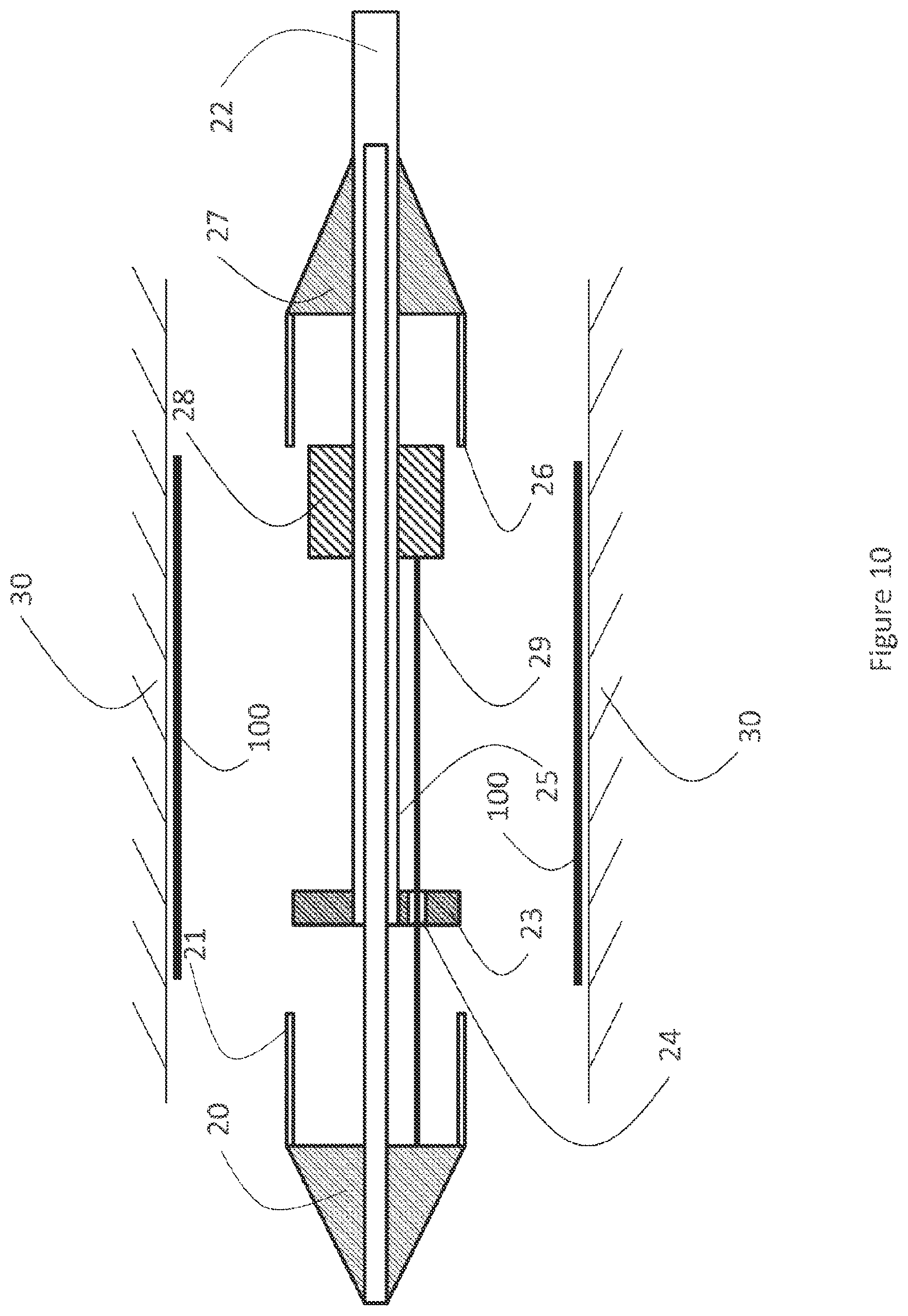 Patent US12616593 Figure 10 – Heart valve prosthesis delivery system and method for delivery of heart valve prosthesis with introducer sheath and loading system