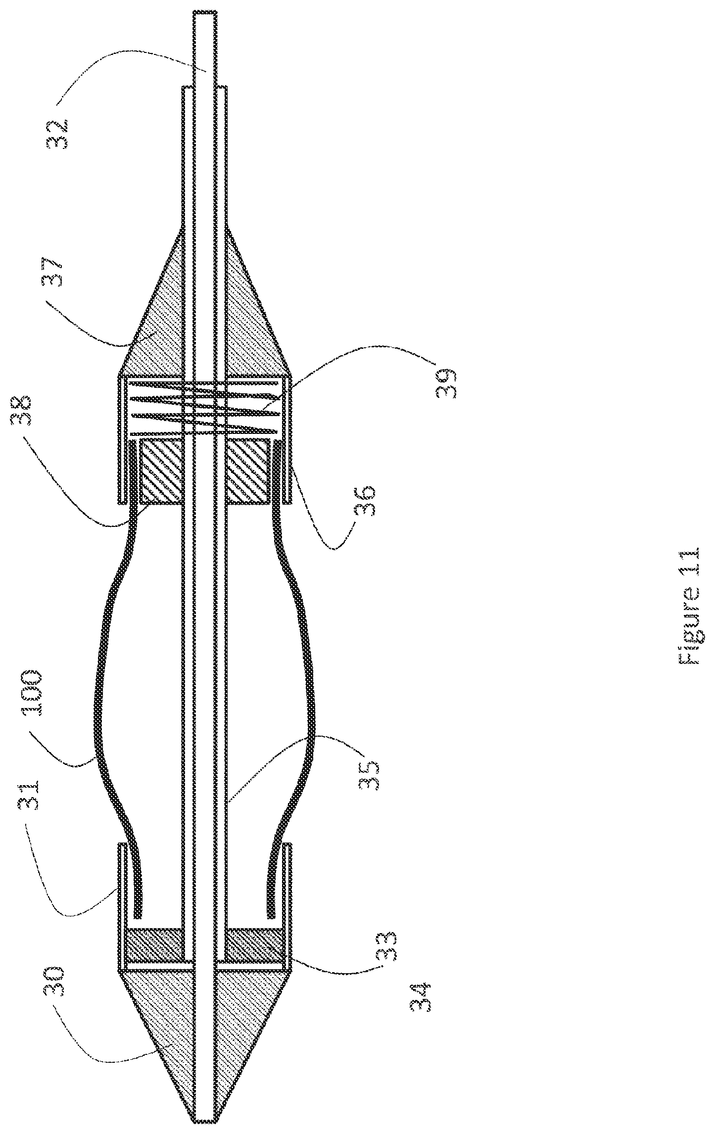 Patent US12616593 Figure 11 – Heart valve prosthesis delivery system and method for delivery of heart valve prosthesis with introducer sheath and loading system