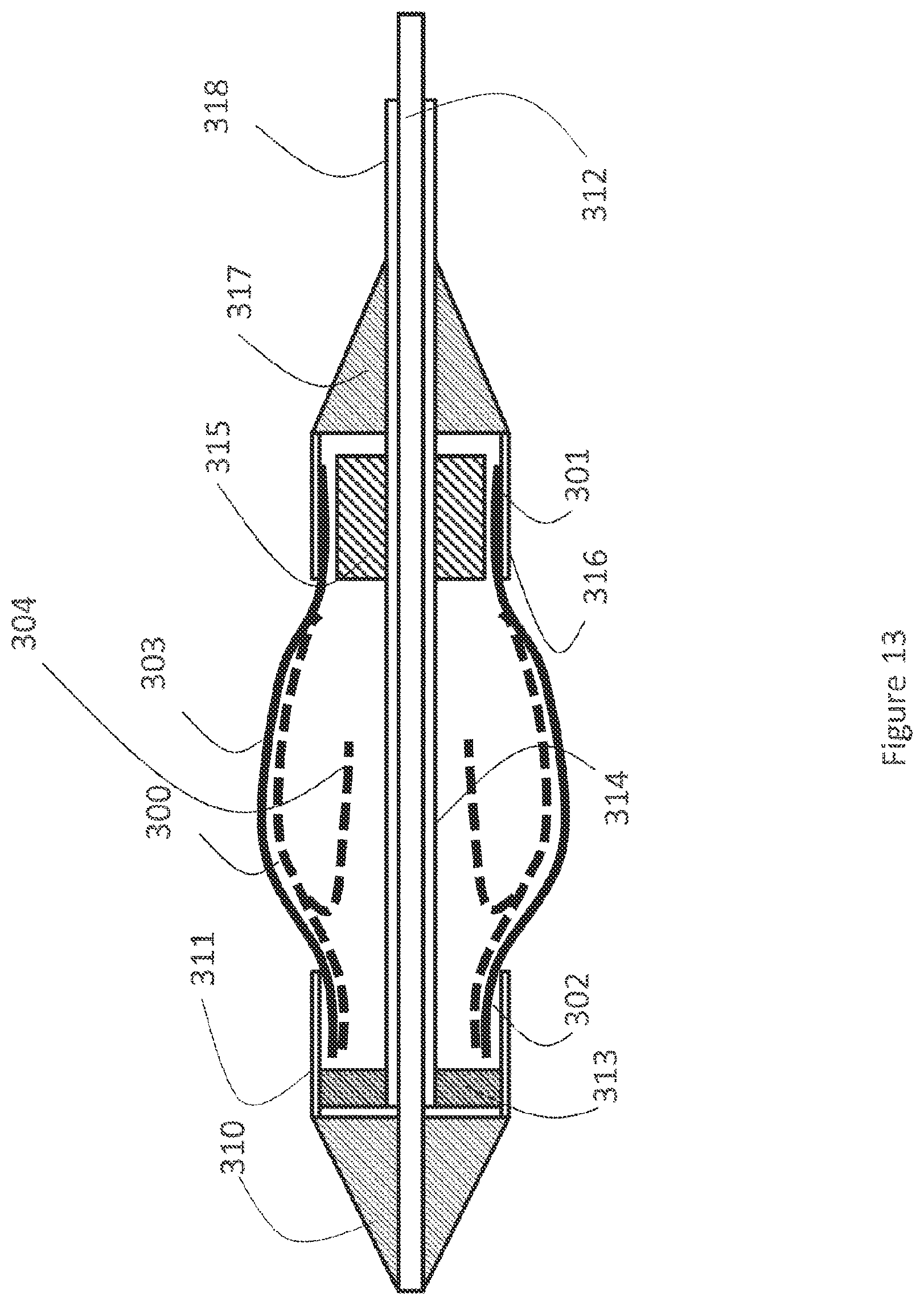 Patent US12616593 Figure 13 – Heart valve prosthesis delivery system and method for delivery of heart valve prosthesis with introducer sheath and loading system