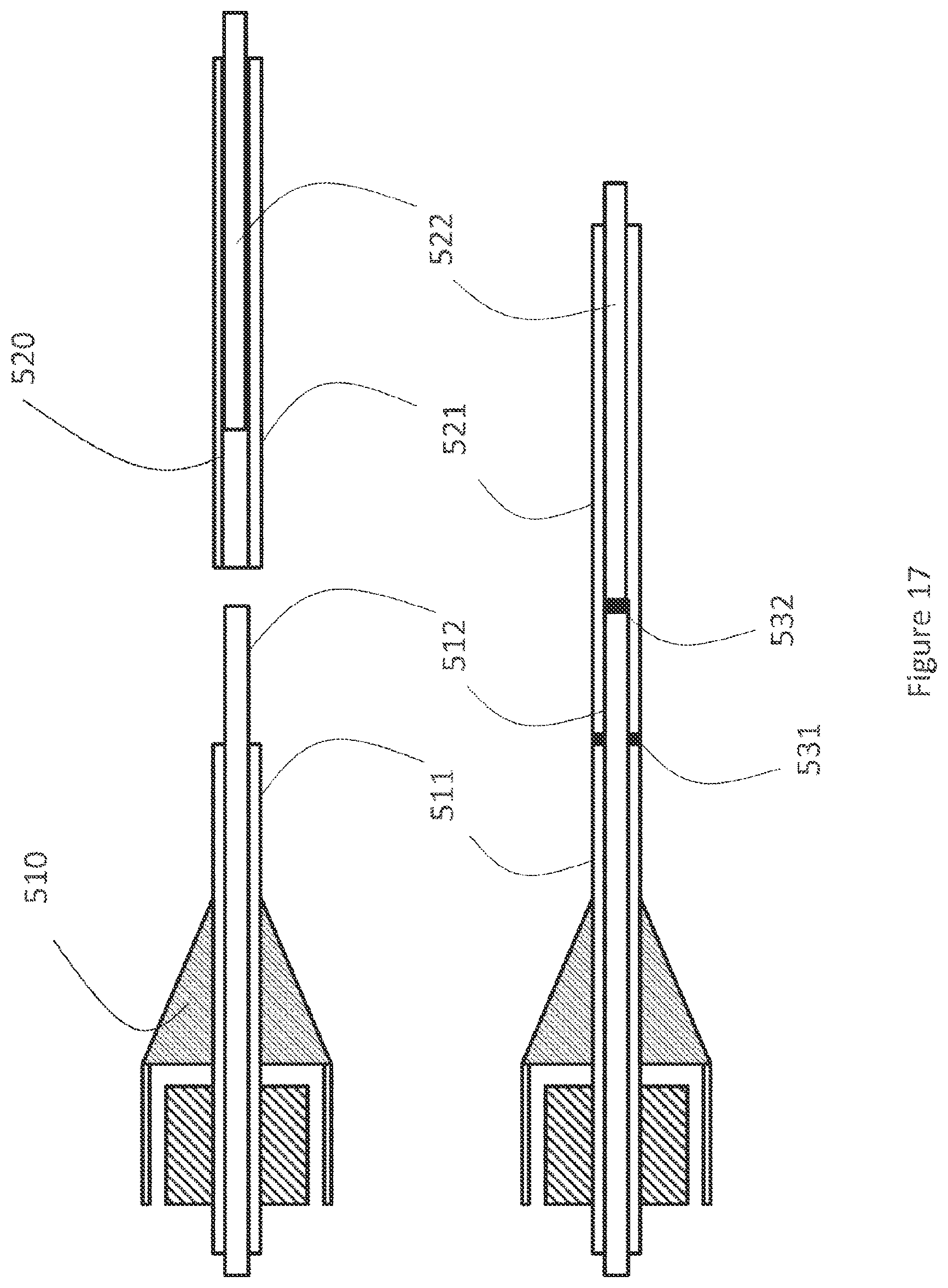 Patent US12616593 Figure 17 – Heart valve prosthesis delivery system and method for delivery of heart valve prosthesis with introducer sheath and loading system